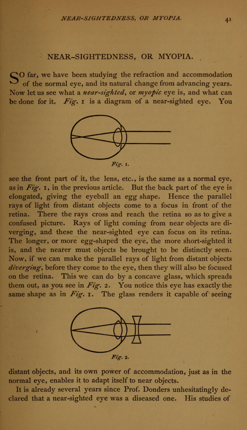 NEAR-SIGHTEDNESS, OR MYOPIA. QO far, we have been studying the refraction and accommodation ^ of the normal eye, and its natural change from advancing years. Now let us see what a near-sighted, or myopic eye is, and what can be done for it.. Fig. 1 is a diagram of a near-sighted eye. You Fig. 1. see the front part of it, the lens, etc., is the same as a normal eye, as in Fig. 1, in the previous article. But the back part of the eye is elongated, giving the eyeball an egg shape. Hence the parallel rays of light from distant objects come to a focus in front of the retina. There the rays cross and reach the retina so as to give a confused picture. Rays of light coming from near objects are di- verging, and these the near-sighted eye can focus on its retina. The longer, or more egg-shaped the eye, the more short-sighted it is, and the nearer must objects be brought to be distinctly seen. Now, if we can make the parallel rays of light from distant objects diverging, before they come to the eye, then they will also be focused on the retina. This we can do by a concave glass, which spreads them out, as you see in Fig. 2. You notice this eye has exactly the same shape as in Fig. 1. The glass renders it capable of seeing Fig. 2. distant objects, and its own power of accommodation, just as in the normal eye, enables it to adapt itself to near objects. It is already several years since Prof. Donders unhesitatingly de- clared that a near-sighted eye was a diseased one. His studies of
