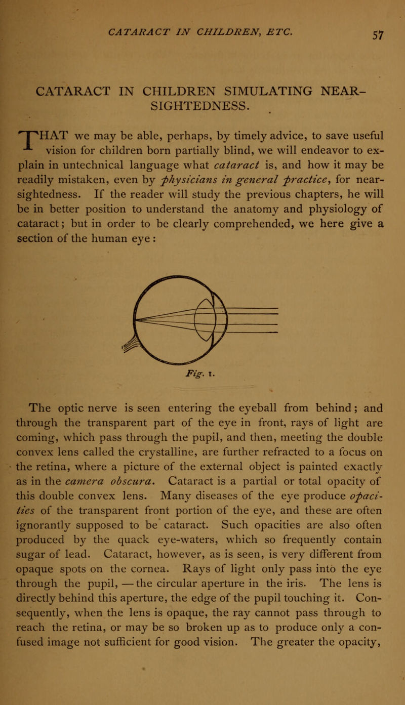 CATARACT IN CHILDREN SIMULATING NEAR- SIGHTEDNESS. 'F^HAT we may be able, perhaps, by timely advice, to save useful ■*• vision for children born partially blind, we will endeavor to ex- plain in untechnical language what cataract is, and how it may be readily mistaken, even by -physicians in general -practice, for near- sightedness. If the reader will study the previous chapters, he will be in better position to understand the anatomy and physiology of cataract; but in order to be clearly comprehended, we here give a section of the human eye : Fig. 1. The optic nerve is seen entering the eyeball from behind ; and through the transparent part of the eye in front, rays of light are coming, which pass through the pupil, and then, meeting the double convex lens called the crystalline, are further refracted to a focus on the retina, where a picture of the external object is painted exactly as in the camera obscura. Cataract is a partial or total opacity of this double convex lens. Many diseases of the eye produce opaci- ties of the transparent front portion of the eye, and these are often ignorantly supposed to be cataract. Such opacities are also often produced by the quack eye-waters, which so frequently contain sugar of lead. Cataract, however, as is seen, is very different from opaque spots on the cornea. Rays of light only pass into the eye through the pupil, —the circular aperture in the iris. The lens is directly behind this aperture, the edge of the pupil touching it. Con- sequently, when the lens is opaque, the ray cannot pass through to reach the retina, or may be so broken up as to produce only a con- fused image not sufficient for good vision. The greater the opacity,