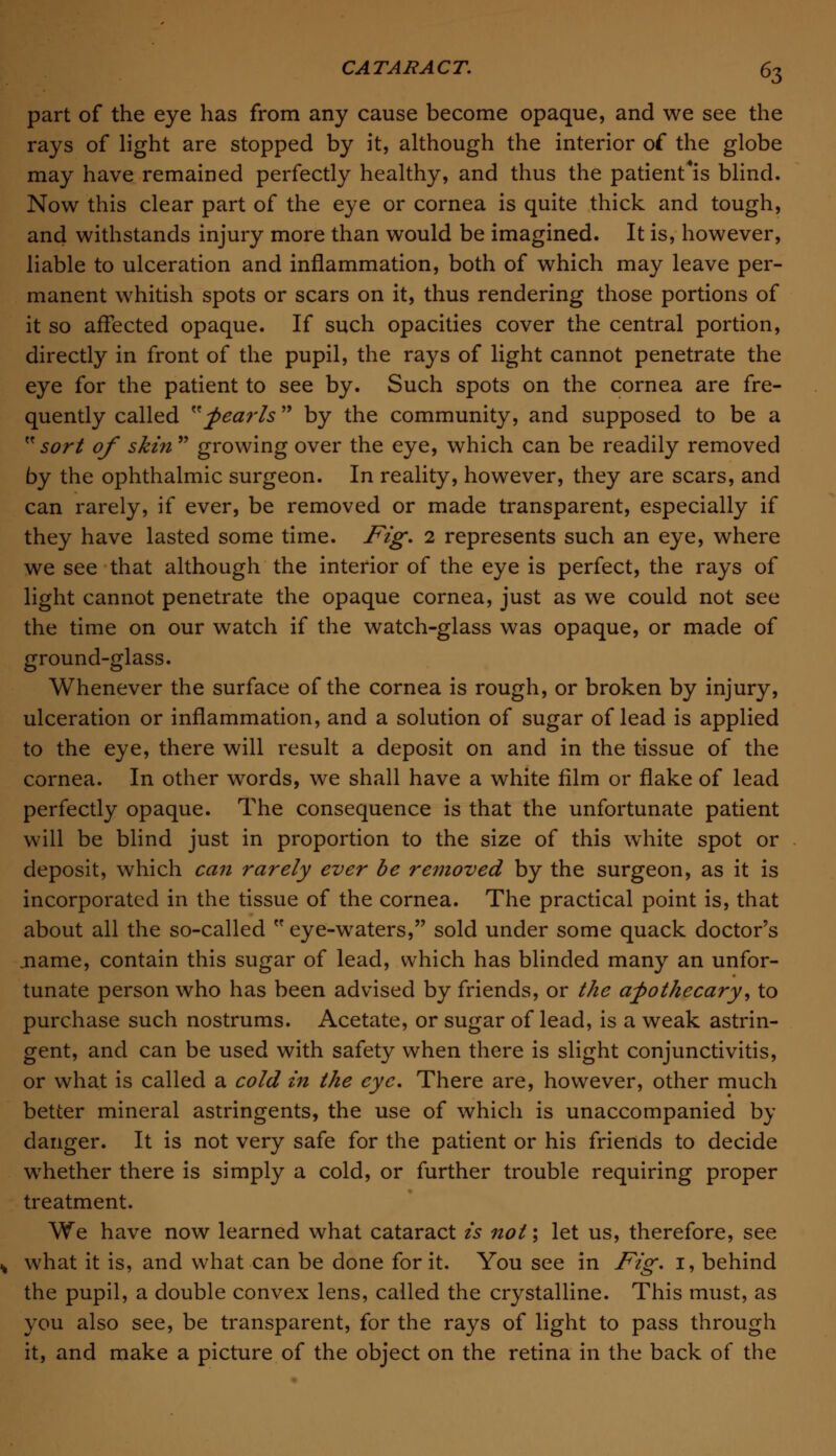 part of the eye has from any cause become opaque, and we see the rays of light are stopped by it, although the interior of the globe may have remained perfectly healthy, and thus the patient*is blind. Now this clear part of the eye or cornea is quite thick and tough, and withstands injury more than would be imagined. It is, however, liable to ulceration and inflammation, both of which may leave per- manent whitish spots or scars on it, thus rendering those portions of it so affected opaque. If such opacities cover the central portion, directly in front of the pupil, the rays of light cannot penetrate the eye for the patient to see by. Such spots on the cornea are fre- quently called pearls by the community, and supposed to be a  sort of skin  growing over the eye, which can be readily removed by the ophthalmic surgeon. In reality, however, they are scars, and can rarely, if ever, be removed or made transparent, especially if they have lasted some time. Fig. 2 represents such an eye, where we see that although the interior of the eye is perfect, the rays of light cannot penetrate the opaque cornea, just as we could not see the time on our watch if the watch-glass was opaque, or made of ground-glass. Whenever the surface of the cornea is rough, or broken by injury, ulceration or inflammation, and a solution of sugar of lead is applied to the eye, there will result a deposit on and in the tissue of the cornea. In other words, we shall have a white film or flake of lead perfectly opaque. The consequence is that the unfortunate patient will be blind just in proportion to the size of this white spot or deposit, which can rarely ever be removed by the surgeon, as it is incorporated in the tissue of the cornea. The practical point is, that about all the so-called  eye-waters, sold under some quack doctor's .name, contain this sugar of lead, which has blinded many an unfor- tunate person who has been advised by friends, or the apothecary', to purchase such nostrums. Acetate, or sugar of lead, is a weak astrin- gent, and can be used with safety when there is slight conjunctivitis, or what is called a cold in the eye. There are, however, other much better mineral astringents, the use of which is unaccompanied by danger. It is not very safe for the patient or his friends to decide whether there is simply a cold, or further trouble requiring proper treatment. We have now learned what cataract is not; let us, therefore, see what it is, and what can be done for it. You see in Fig. 1, behind the pupil, a double convex lens, called the crystalline. This must, as you also see, be transparent, for the rays of light to pass through it, and make a picture of the object on the retina in the back of the