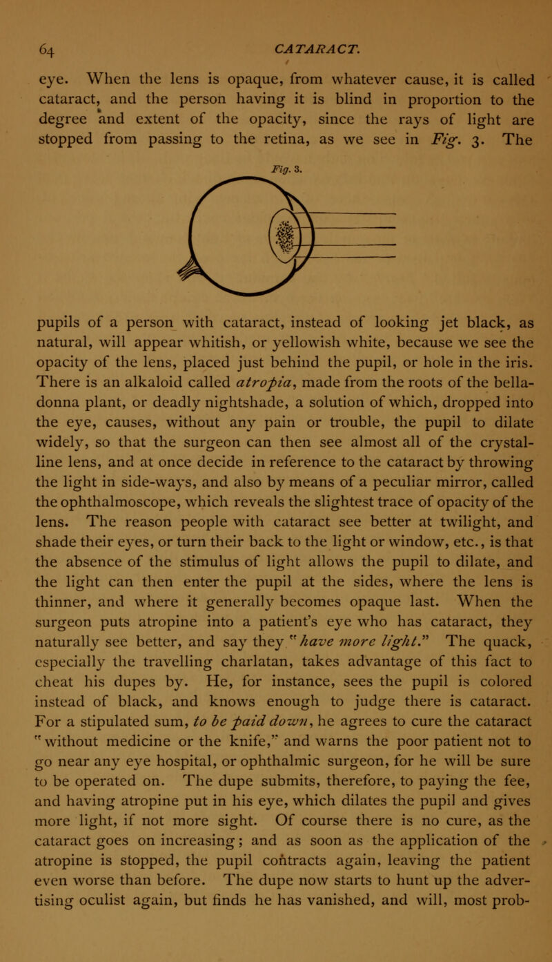 eye. When the lens is opaque, from whatever cause, it is called cataract, and the person having it is blind in proportion to the degree and extent of the opacity, since the rays of light are stopped from passing to the retina, as we see in Fig. 3. The Fig. 3. pupils of a person with cataract, instead of looking jet black, as natural, will appear whitish, or yellowish white, because we see the opacity of the lens, placed just behind the pupil, or hole in the iris. There is an alkaloid called atropia, made from the roots of the bella- donna plant, or deadly nightshade, a solution of which, dropped into the eye, causes, without any pain or trouble, the pupil to dilate widely, so that the surgeon can then see almost all of the crystal- line lens, and at once decide in reference to the cataract by throwing the light in side-ways, and also by means of a peculiar mirror, called the ophthalmoscope, which reveals the slightest trace of opacity of the lens. The reason people with cataract see better at twilight, and shade their eyes, or turn their back to the light or window, etc., is that the absence of the stimulus of light allows the pupil to dilate, and the light can then enter the pupil at the sides, where the lens is thinner, and where it generally becomes opaque last. When the surgeon puts atropine into a patient's eye who has cataract, they naturally see better, and say they have more light The quack, especially the travelling charlatan, takes advantage of this fact to cheat his dupes by. He, for instance, sees the pupil is colored instead of black, and knows enough to judge there is cataract. For a stipulated sum, to be paid down, he agrees to cure the cataract without medicine or the knife,'* and warns the poor patient not to go near any eye hospital, or ophthalmic surgeon, for he will be sure to be operated on. The dupe submits, therefore, to paying the fee, and having atropine put in his eye, which dilates the pupil and gives more light, if not more sight. Of course there is no cure, as the cataract goes on increasing; and as soon as the application of the atropine is stopped, the pupil contracts again, leaving the patient even worse than before. The dupe now starts to hunt up the adver- tising oculist again, but finds he has vanished, and will, most prob-