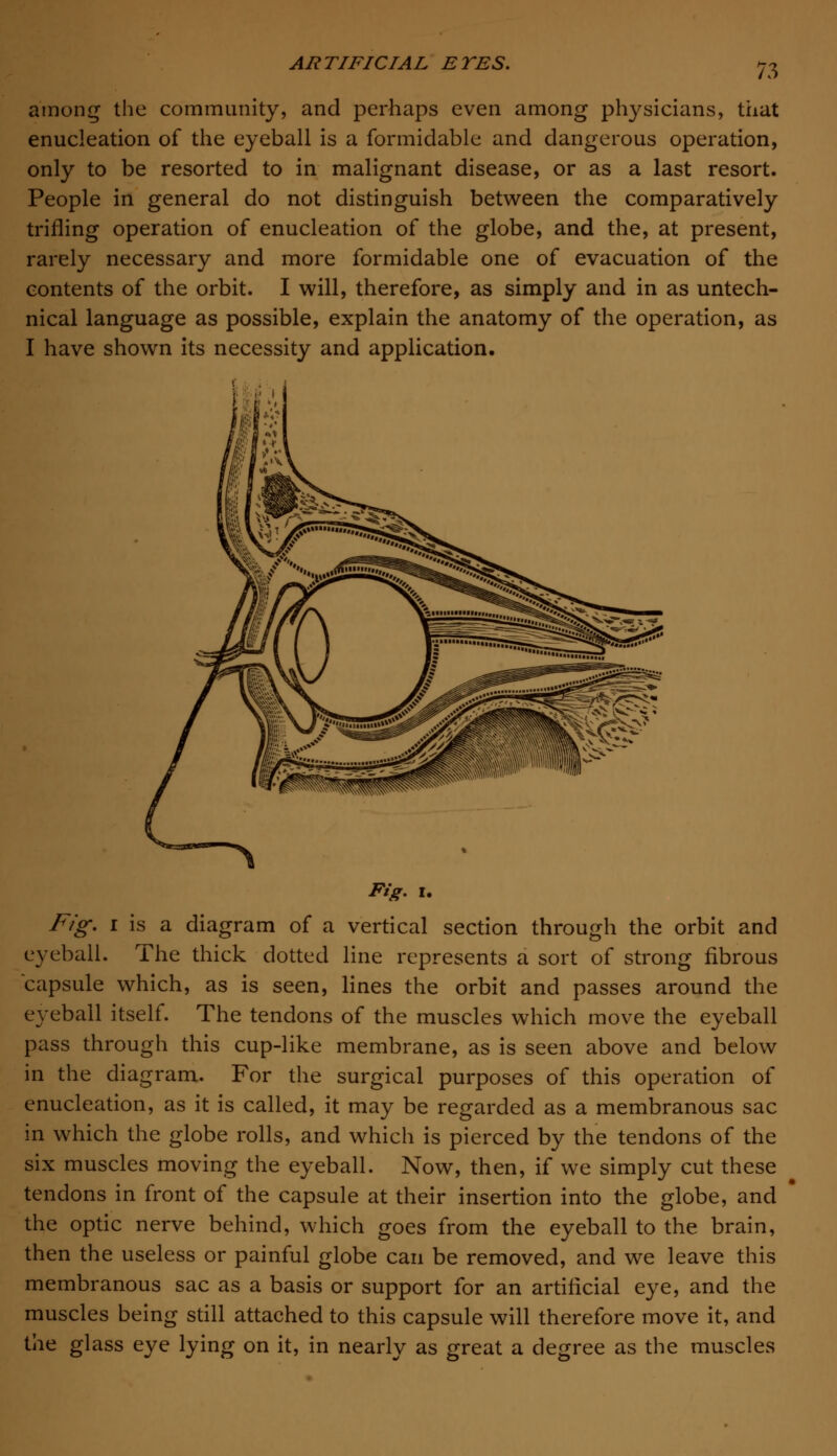 n among the community, and perhaps even among physicians, that enucleation of the eyeball is a formidable and dangerous operation, only to be resorted to in malignant disease, or as a last resort. People in general do not distinguish between the comparatively trifling operation of enucleation of the globe, and the, at present, rarely necessary and more formidable one of evacuation of the contents of the orbit. I will, therefore, as simply and in as untech- nical language as possible, explain the anatomy of the operation, as I have shown its necessity and application. Fig. i. Fig. i is a diagram of a vertical section through the orbit and eyeball. The thick dotted line represents a sort of strong fibrous capsule which, as is seen, lines the orbit and passes around the eyeball itself. The tendons of the muscles which move the eyeball pass through this cup-like membrane, as is seen above and below in the diagram. For the surgical purposes of this operation of enucleation, as it is called, it may be regarded as a membranous sac in which the globe rolls, and which is pierced by the tendons of the six muscles moving the eyeball. Now, then, if we simply cut these tendons in front of the capsule at their insertion into the globe, and the optic nerve behind, which goes from the eyeball to the brain, then the useless or painful globe can be removed, and we leave this membranous sac as a basis or support for an artificial eye, and the muscles being still attached to this capsule will therefore move it, and the glass eye lying on it, in nearly as great a degree as the muscles