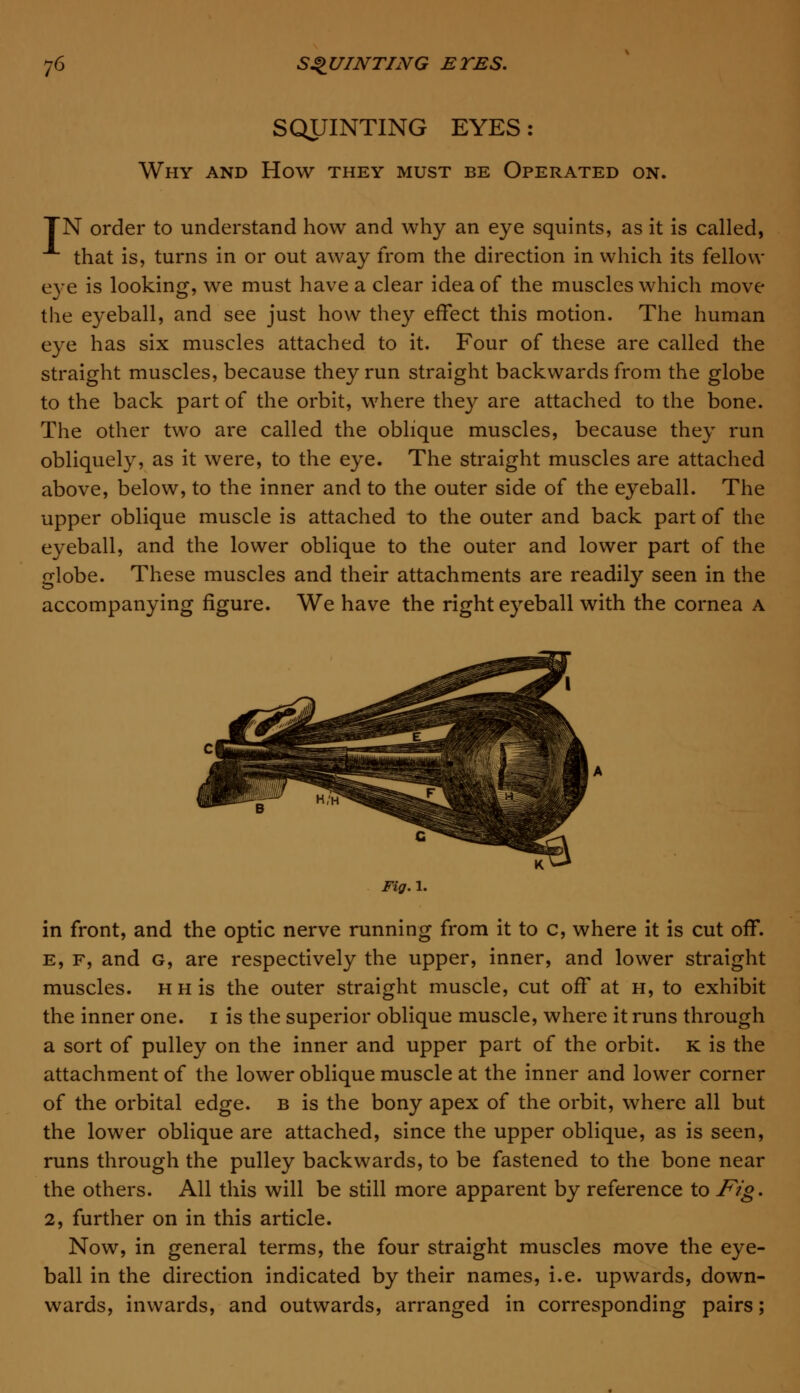 SQUINTING EYES: Why and How they must be Operated on. TN order to understand how and why an eye squints, as it is called, that is, turns in or out away from the direction in which its fellow eye is looking, we must have a clear idea of the muscles which move the eyeball, and see just how they effect this motion. The human eye has six muscles attached to it. Four of these are called the straight muscles, because they run straight backwards from the globe to the back part of the orbit, where they are attached to the bone. The other two are called the oblique muscles, because they run obliquely, as it were, to the eye. The straight muscles are attached above, below, to the inner and to the outer side of the eyeball. The upper oblique muscle is attached to the outer and back part of the eyeball, and the lower oblique to the outer and lower part of the globe. These muscles and their attachments are readily seen in the accompanying figure. We have the right eyeball with the cornea a Fig. 1. in front, and the optic nerve running from it to c, where it is cut off. e, f, and g, are respectively the upper, inner, and lower straight muscles. HHis the outer straight muscle, cut off at h, to exhibit the inner one. i is the superior oblique muscle, where it runs through a sort of pulley on the inner and upper part of the orbit, k is the attachment of the lower oblique muscle at the inner and lower corner of the orbital edge, b is the bony apex of the orbit, where all but the lower oblique are attached, since the upper oblique, as is seen, runs through the pulley backwards, to be fastened to the bone near the others. All this will be still more apparent by reference to Fig. 2, further on in this article. Now, in general terms, the four straight muscles move the eye- ball in the direction indicated by their names, i.e. upwards, down- wards, inwards, and outwards, arranged in corresponding pairs;