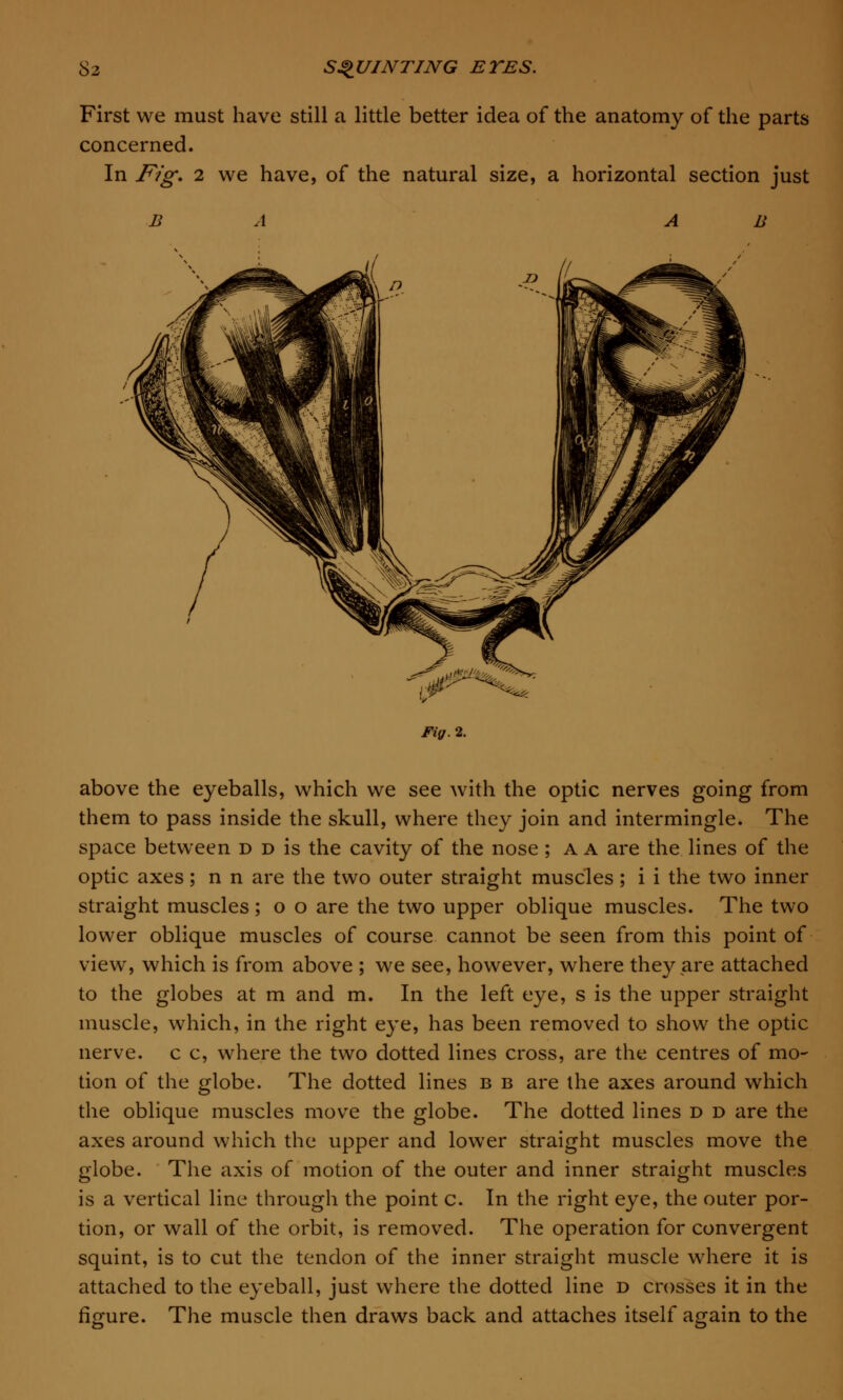 First we must have still a little better idea of the anatomy of the parts concerned. In Fig. 2 we have, of the natural size, a horizontal section just u above the eyeballs, which we see with the optic nerves going from them to pass inside the skull, where they join and intermingle. The space between d d is the cavity of the nose ; a a are the lines of the optic axes; n n are the two outer straight muscles ; i i the two inner straight muscles ; o o are the two upper oblique muscles. The two lower oblique muscles of course cannot be seen from this point of view, which is from above ; we see, however, where they are attached to the globes at m and m. In the left eye, s is the upper straight muscle, which, in the right eye, has been removed to show the optic nerve, c c, where the two dotted lines cross, are the centres of mo- tion of the globe. The dotted lines b b are the axes around which the oblique muscles move the globe. The dotted lines d d are the axes around which the upper and lower straight muscles move the globe. The axis of motion of the outer and inner straight muscles is a vertical line through the point c. In the right eye, the outer por- tion, or wall of the orbit, is removed. The operation for convergent squint, is to cut the tendon of the inner straight muscle where it is attached to the eyeball, just where the dotted line d crosses it in the figure. The muscle then draws back and attaches itself again to the