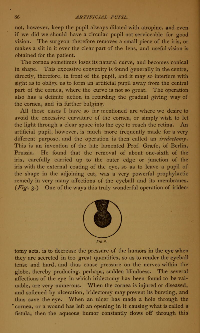 not, however, keep the pupil always dilated with atropine, and even if we did we should have a circular pupil not serviceable for good vision. The surgeon therefore removes a small piece of the iris, or makes a slit in it over the clear part of the lens, and useful vision is obtained for the patient. The cornea sometimes loses its natural curve, and becomes conical in shape. This excessive convexity is found generally in the centre, directly, therefore, in front of the pupil, and it may so interfere with sight as to oblige us to form an artificial pupil away from the central part of the cornea, where the curve is not so great. The operation also has a definite action in retarding the gradual giving way of the cornea, and its further bulging. All these cases I have so far mentioned are where we desire to avoid the excessive curvature of the cornea, or simply wish to let the light through a clear space into the eye to reach the retina. An artificial pupil, however, is much more frequently made for a very different purpose, and the operation is then called an iridectomy. This is an invention of the late lamented Prof. Grsefe, of Berlin, Prussia. He found that the removal of about one-sixth of the iris, carefully carried up to the outer edge or junction of the iris with the external coating of the eye, so as to leave a pupil of the shape in the adjoining cut, was a very powerful prophylactic remedy in very many affections of the eyeball and its membranes. (Fig. 3.) One of the ways this truly wonderful operation of iridec- FiQ. 6. tomy acts, is to decrease the pressure of the humors in the eye when they are secreted in too great quantities, so as to render the eyeball tense and hard, and thus cause pressure on the nerves within the globe, thereby producing, perhaps, sudden blindness. The several affections of the eye in which iridectomy has been found to be val- uable, are very numerous. When the cornea is injured or diseased, and softened by ulceration, iridectomy may prevent its bursting, and thus save the eye. When an ulcer has made a hole through the * cornea, or a wound has left an opening in it causing what is called a fistula, then the aqueous humor constantly flows off through this