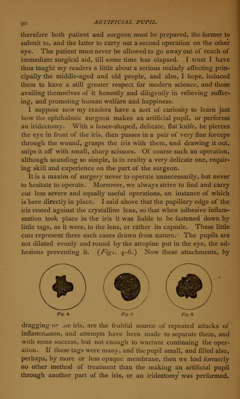 therefore both patient and surgeon must be prepared, the former to submit to, and the latter to carry out a second operation on the other eye. The patient must never be allowed to go away out of reach of immediate surgical aid, till some time has elapsed. I trust I have thus taught my readers a little about a serious malady affecting prin- cipally the middle-aged and old people, and also, I hope, induced them to have a still greater respect for modern science, and those availing themselves of it honestly and diligently in relieving suffer- ing, and promoting human welfare and happiness. I suppose now my readers have a sort of curiosity to learn just how the ophthalmic surgeon makes an artificial pupil, or performs an iridectomy. With a lance-shaped, delicate, flat knife, he pierces the eye in front of the iris, then passes in a pair of very fine forceps through the wound, grasps the iris with them, and drawing it out, snips it off with small, sharp scissors. Of course such an operation, although sounding so simple, is in reality a very delicate one, requir- ing skill and experience on the part of the surgeon. It is a maxim of surgery never to operate unnecessarily, but never to hesitate to operate. Moreover, we always strive to find and carry out less severe and equally useful operations, an instance of which is here directly in place. I said above that the pupillary edge of the iris rested against the crystalline lens, so that when adhesive inflam- mation took place in the iris it was liable to be fastened down by little tags, as it were, to the lens, or rather its capsule. These little cuts represent three such cases drawn from nature.* The pupils are not dilated evenly and round by the atropine put in the eye, the ad- hesions preventing it. (Figs. 4-6.) Now these attachments, by Fig. 4. Fig. 5 Fig. 6. dragging or .l)e iris, are the fruitful source of repeated attacks of inflammation, and attempts have been made to separate them, and with some success, but not enough to warrant continuing the oper- ation. If these tags were many, and the pupil small, and filled also, perhaps, by more or less opaque membrane, then we had formerly no other method of treatment than the making an artificial pupil through another part of the iris, or an iridectomy was performed.