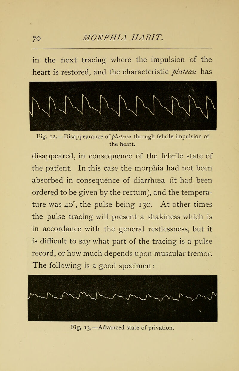 in the next tracing where the impulsion of the heart is restored, and the characteristic plateau has Fig. 12.—Disappearance oiplateau through febrile impulsion of the heart. disappeared, in consequence of the febrile state of the patient. In this case the morphia had not been absorbed in consequence of diarrhoea (it had been ordered to be given by the rectum), and the tempera- ture was 40°, the pulse being 130. At other times the pulse tracing will present a shakiness which is in accordance with the general restlessness, but it is difficult to say what part of the tracing is a pulse record, or how much depends upon muscular tremor. The following is a good specimen : I^'ig* 13'—Advanced state of privation.