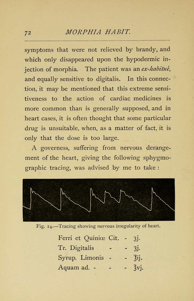 symptoms that were not relieved by brandy, and which only disappeared upon the hypodermic in- jection of morphia. The patient was an ex-habitiie, and equally sensitive to digitalis. In this connec- tion, it may be mentioned that this extreme sensi- tiveness to the action of cardiac medicines is more common than is generally supposed, and in heart cases, it is often thought that some particular drug is unsuitable, when, as a matter of fact, it is only that the dose is too large. A governess, suffering from nervous derange- ment of the heart, giving the following sphygmo- graphic tracing, was advised by me to take : Fig. 14.—Tracing showing nervous irregularity of heart. Ferri et Quinioi Cit. - 3J. Tr. Digitalis - - 3J. Syrup. Limonis - - ^ij. Aquam ad. - - - ^vj.