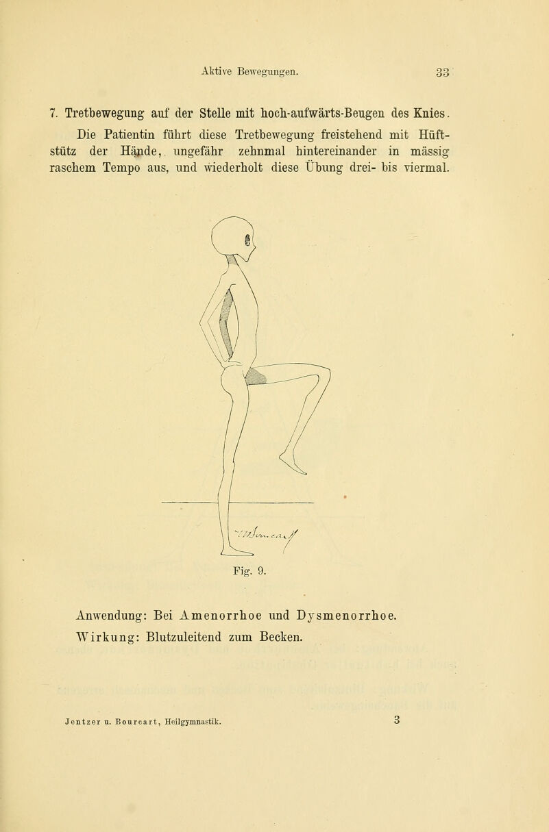 7. Tretbewegung auf der Stelle mit hoch-aufwärts-Beugen des Knies. Die Patientin führt diese Tretbewegung freistehend mit Hüft- stütz der Häjide, ungefähr zehnmal hintereinander in massig raschem Tempo aus, und wiederholt diese Übung drei- bis viermal. Fig. 9. Anwendung: Bei Amenorrhoe und Dysmenorrhoe. Wirkung: Blutzuleitend zum Becken. Jentzer u. Boureart, Heilgymnastik.