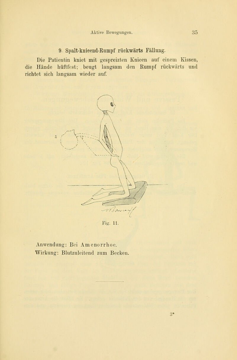 9. Spalt-knieend-Rumpf rückwärts Fälluiig. Die Patientin kniet mit gespreizten Knieen auf einem Kissen, die Hände Mftfest; beugt langsam den richtet sich langsam wieder auf. Rumpf rückwärts und FJg. 11. Anwendung: Bei Amenorrhoe. Wirkung: Blutzuleitend zum Becken.