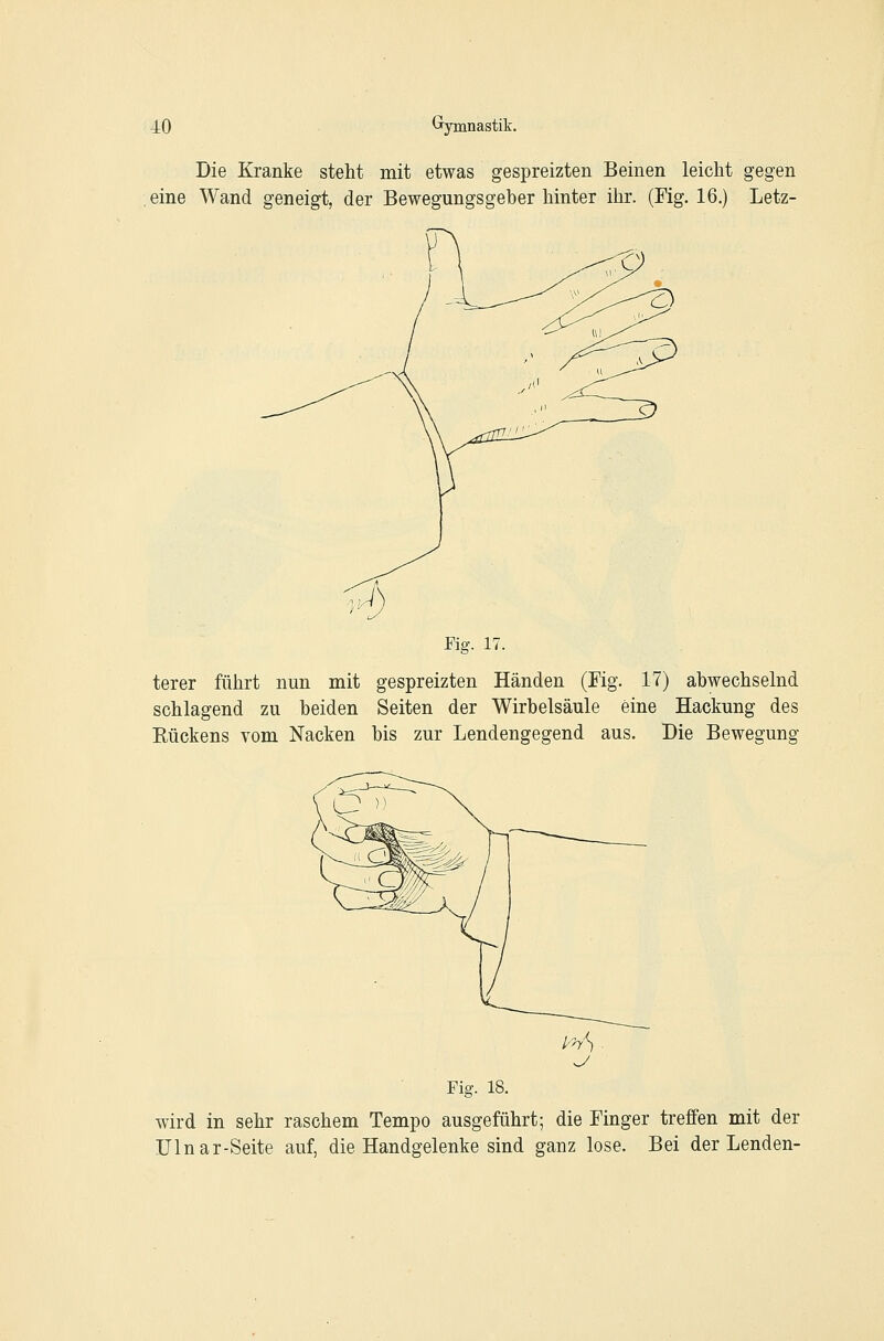 Die Kranke steht mit etwas gespreizten Beinen leicht gegen eine Wand geneigt, der Bewegungsgeber hinter ihr. (Fig. 16.) Letz- Fig. 17. terer führt nun mit gespreizten Händen (Fig. 17) abwechselnd schlagend zu beiden Seiten der Wirbelsäule eine Hackung des Kückens vom Nacken bis zur Lendengegend aus. Die Bewegung Fig. 18. wird in sehr raschem Tempo ausgeführt; die Finger treffen mit der Ülnar-Seite auf, die Handgelenke sind ganz lose. Bei der Lenden-