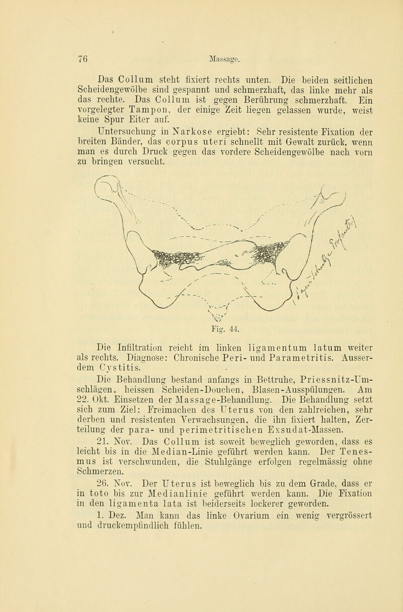 Das Collum steht fixiert rechts unten. Die beiden seitlichen Scheidengewölbe sind gespannt und schmerzhaft, das linke mehr als das rechte. Das Collum ist gegen Berührung schmerzhaft. Ein vorgelegter Tampon, der einige Zeit liegen gelassen wurde, weist keine Spur Eiter auf. Untersuchung in iSTarkose ergiebt: Sehr resistente Fixation der breiten Bänder, das corpus uteri schnellt mit Gewalt zurück, wenn man es durch Druck gegen das vordere Scheidengewölbe nach vorn zu bringen versucht. Fig. 44. Die Infiltration reicht im linken ligamentum latum weiter als rechts. Diagnose: Chronische Peri-und Parametritis. Ausser- dem Cystitis. Die Behandlung bestand anfangs in Bettruhe, Priessnitz-Um- schlägen, heissen Scheiden-Douchen, Blasen-Ausspülungen. Am 22. Okt. Einsetzen der Massage-Behandlung. Die Behandlung setzt sich zum Ziel: Freimachen des Uterus von den zahlreichen, sehr derben und resistenten Verwachsungen, die ihn fixiert halten, Zer- teilung der para- und perimetritischen Exsudat-Massen. 21. Nov. Das Collum ist soweit beweglich geworden, dass es leicht bis in die Median-Linie geführt werden kann. Der Tenes- mus ist verschwunden, die Stuhlgänge erfolgen regelmässig ohne Schmerzen, 26. Nov. Der Uterus ist beweglich bis zu dem Grade, dass er in toto bis zur Medianlinie geführt werden kann. Die Fixation in den ligamenta lata ist beiderseits lockerer geworden. 1. Dez. Man kann das linke Ovarium ein wenig vergrössert und druckempfindlich fühlen.