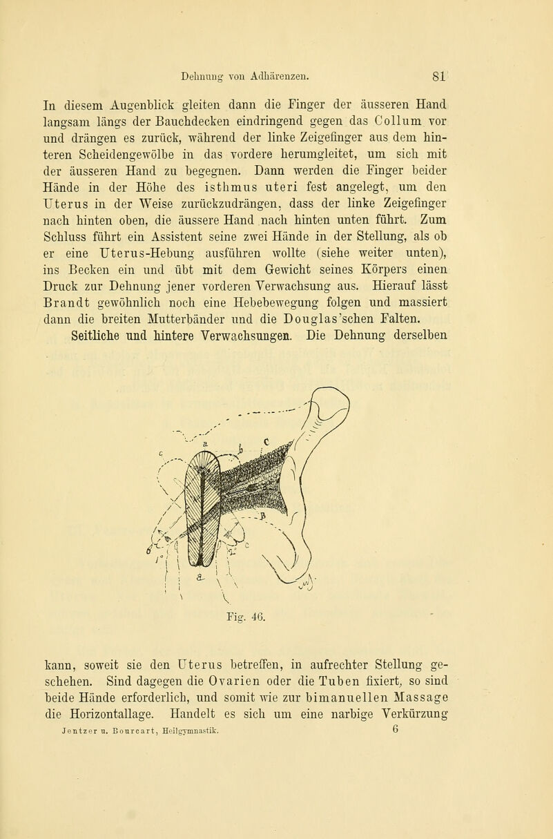 In diesem Augenblick gleiten dann die Finger der äusseren Hand langsam längs der Bauchdecken eindringend gegen das Collum vor und drängen es zurück, während der linke Zeigefinger aus dem hin- teren Scheidengewölbe in das vordere herumgleitet, um sich mit der äusseren Hand zu begegnen. Dann werden die Finger beider Hände in der Höhe des isthmus uteri fest angelegt, um den Uterus in der Weise zurückzudrängen, dass der linke Zeigefinger nach hinten oben, die äussere Hand nach hinten unten führt. Zum Schluss führt ein Assistent seine zwei Hände in der Stellung, als ob er eine Uterus-Hebung ausführen wollte (siehe weiter unten), ins Becken ein und übt mit dem Gewicht seines Körpers einen Druck zur Dehnung jener vorderen Verwachsung aus. Hierauf lässt Brandt gewöhnlich noch eine Hebebewegung folgen und massiert dann die breiten Mutterbänder und die Douglas'sehen Falten. Seitliche und hintere Verwachsungen. Die Dehnung derselben Fig. 46. kann, soweit sie den Uterus betreffen, in aufrechter Stellung ge- schehen. Sind dagegen die Ovarien oder die Tuben fixiert, so sind beide Hände erforderlich, und somit wie zur bimanuellen Massage die Horizontallage. Handelt es sich um eine narbige Verkürzung Jentzer u. Bonrcart, Heilgymnastik. D