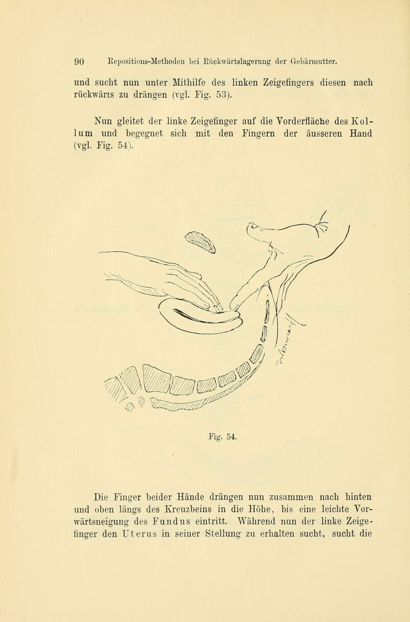 und sucht nun unter Mithilfe des linken Zeigefingers diesen nach rückwärts zu drängen (vgl. Fig. 53). Nun gleitet der linke Zeigefinger auf die Vorderfläclie des Kol- lum und begegnet sich mit den Fingern der äusseren Hand (vgl. Fig. 54). Fig. 54. Die Finger heider Hände drängen nun zusammen nach hinten und oben längs des Kreuzheins in die Höhe, bis eine leichte Vor- wärtsneigung des Fundus eintritt. Während nun der linke Zeige- finger den Uterus in seiner Stellung zu erhalten sucht, sucht die