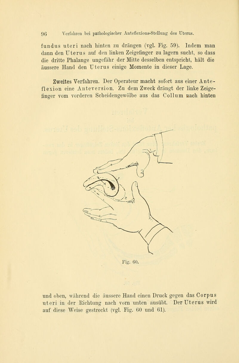 fundus uteri nach hinten zu drängen (vgl. Fig. 59). Indem man dann den Uterus auf den linken Zeigefinger zu lagern sucht, so dass die dritte Phalange ungefähr der Mitte desselben entspricht, hält die äussere Hand den Uterus einige Momente in dieser Lage. Zweites Verfahren. Der Operateur macht sofort aus einer Ante- flexion eine Anteversion. Zu dem Zweck drängt der linke Zeige- finger vom vorderen Scheidengewölbe aus das Collum nach hinten Fig. 60. und oben, während die äussere Hand einen Druck gegen das Corpus uteri in der Eichtuüg nach vorn unten ausübt. Der Uterus wird auf diese Weise gestreckt (vgl. Fig. 60 und 61).