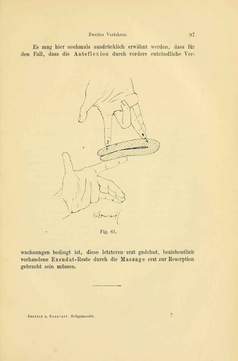 Es mag hier nochmals ausdrücklich erwähnt werden, dass füi den Fall, dass die Anteflexion durch vordere entzündliche Yer- Fiff. 61. wachsungen hedingt ist, diese letzteren erst gedehnt, beziehentlich vorhandene Exsudat-Reste durch die Massäge erst zur Resorption gebracht sein müssen. Jentzer u. Bourcart, Heilgymnastik.