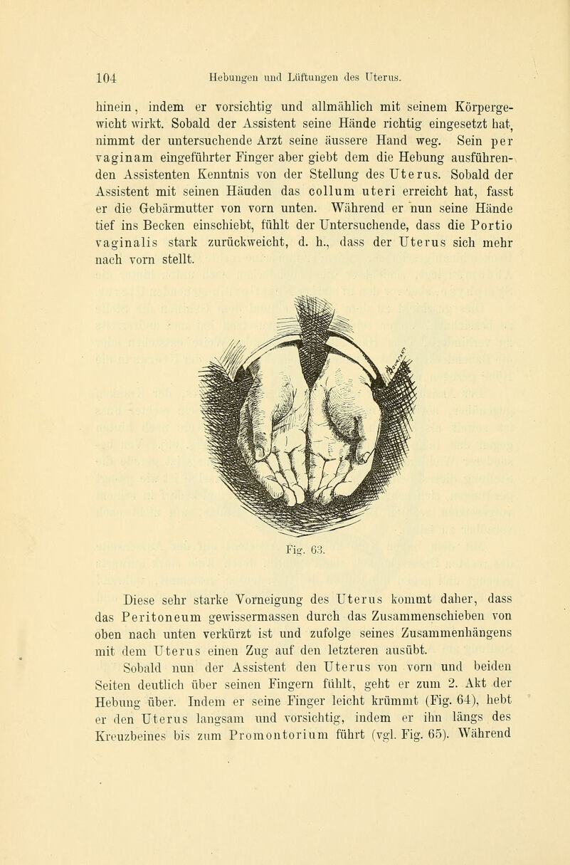 hinein, indem er vorsichtig und allmählich mit seinem Körperge- wicht wirkt. Sobald der Assistent seine Hände richtig eingesetzt hat, nimmt der untersuchende Arzt seine äussere Hand weg. Sein per vaginam eingeführter Finger aber giebt dem die Hebung ausführen- den Assistenten Kenntnis von der Stellung des Uterus. Sobald der Assistent mit seinen Händen das collum uteri erreicht hat, fasst er die Gebärmutter von vorn unten. Während er nun seine Hände tief ins Becken einschiebt, fühlt der Untersuchende, dass die Portio vaginalis stark zurückweicht, d. h., dass der Uterus sich mehr nach vorn stellt. Fig. 63. Diese sehr starke Vorneigung des Uterus kommt daher, dass das Peritoneum gewissermassen durch das Zusammenschieben von oben nach unten verkürzt ist und zufolge seines Zusammenhängens mit dem Uterus einen Zug auf den letzteren ausübt. Sobald nun der Assistent den Uterus von vorn und beiden Seiten deutlich über seinen Fingern fühlt, geht er zum 2. Akt der Hebung über. Indem er seine Finger leicht krümmt (Fig. 64), hebt er den Uterus langsam und vorsichtig, indem er ihn längs des Kreuzbeines bis zum Promontorium führt (vgl. Fig. 65). Während