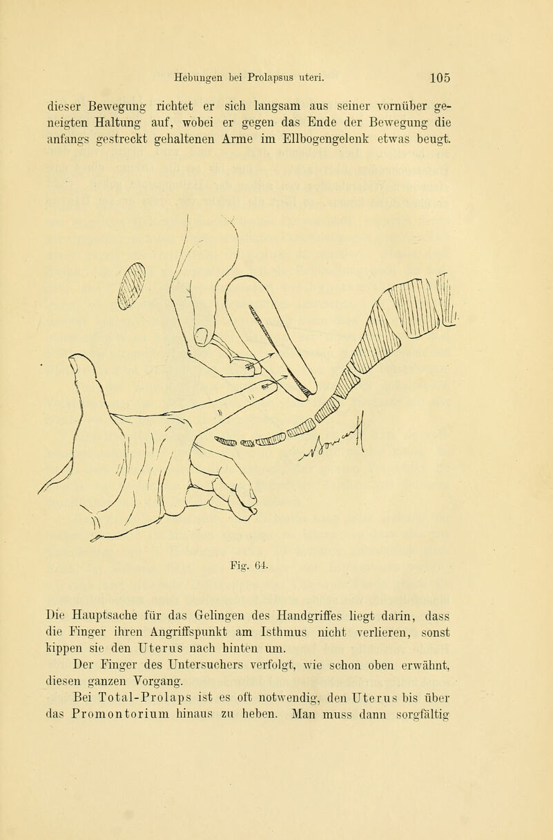 dieser Bewegung richtet er sich langsam aus seiner vornüber ge- neigten Haltung auf, wobei er gegen das Ende der Bewegung die anfangs gestreckt gehaltenen Arme im Ellbogengelenk etwas beugt. Fig. 64. Die Hauptsache für das Gelingen des Handgriffes liegt darin, dass die Einger ihren Angriffspunkt am Isthmus nicht verlieren, sonst kippen sie den Uterus nach hinten um. Der Finger des TJntersuchers verfolgt, wie schon oben erwähnt, diesen ganzen Vorgang. Bei Total-Prolaps ist es oft notwendig, den Uterus bis über das Promontorium hinaus zu heben. Man muss dann sorgfältig