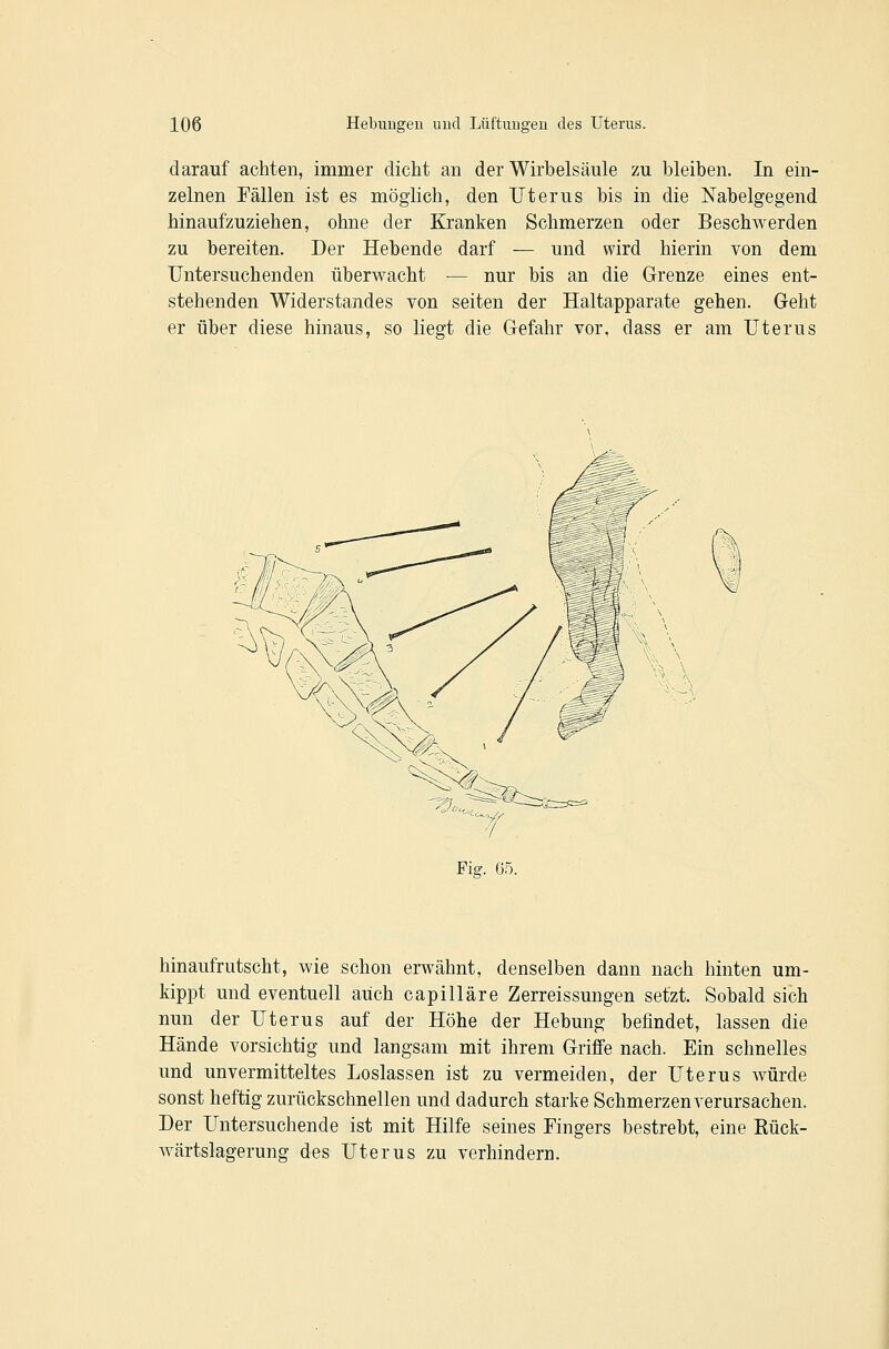 darauf achten, immer dicht an der Wirbelsäule zu bleiben. In ein- zelnen Fällen ist es möglich, den Uterus bis in die Nabelgegend hinaufzuziehen, ohne der Kranken Schmerzen oder Beschwerden zu bereiten. Der Hebende darf — und wird hierin von dem Untersuchenden überwacht — nur bis an die Grenze eines ent- stehenden Widerstandes von selten der Haltapparate gehen. Geht er über diese hinaus, so liegt die Gefahr vor, dass er am Uterus hinaufrutscht, wie schon erwähnt, denselben dann nach hinten um- kippt und eventuell auch capilläre Zerreissungen setzt. Sobald sich nun der Uterus auf der Höhe der Hebung befindet, lassen die Hände vorsichtig und langsam mit ihrem Griffe nach. Ein schnelles und unvermitteltes Loslassen ist zu vermeiden, der Uterus würde sonst heftig zurückschnellen und dadurch starke Schmerzen verursachen. Der Untersuchende ist mit Hilfe seines Fingers bestrebt, eine Kück- wärtslagerung des Uterus zu verhindern.