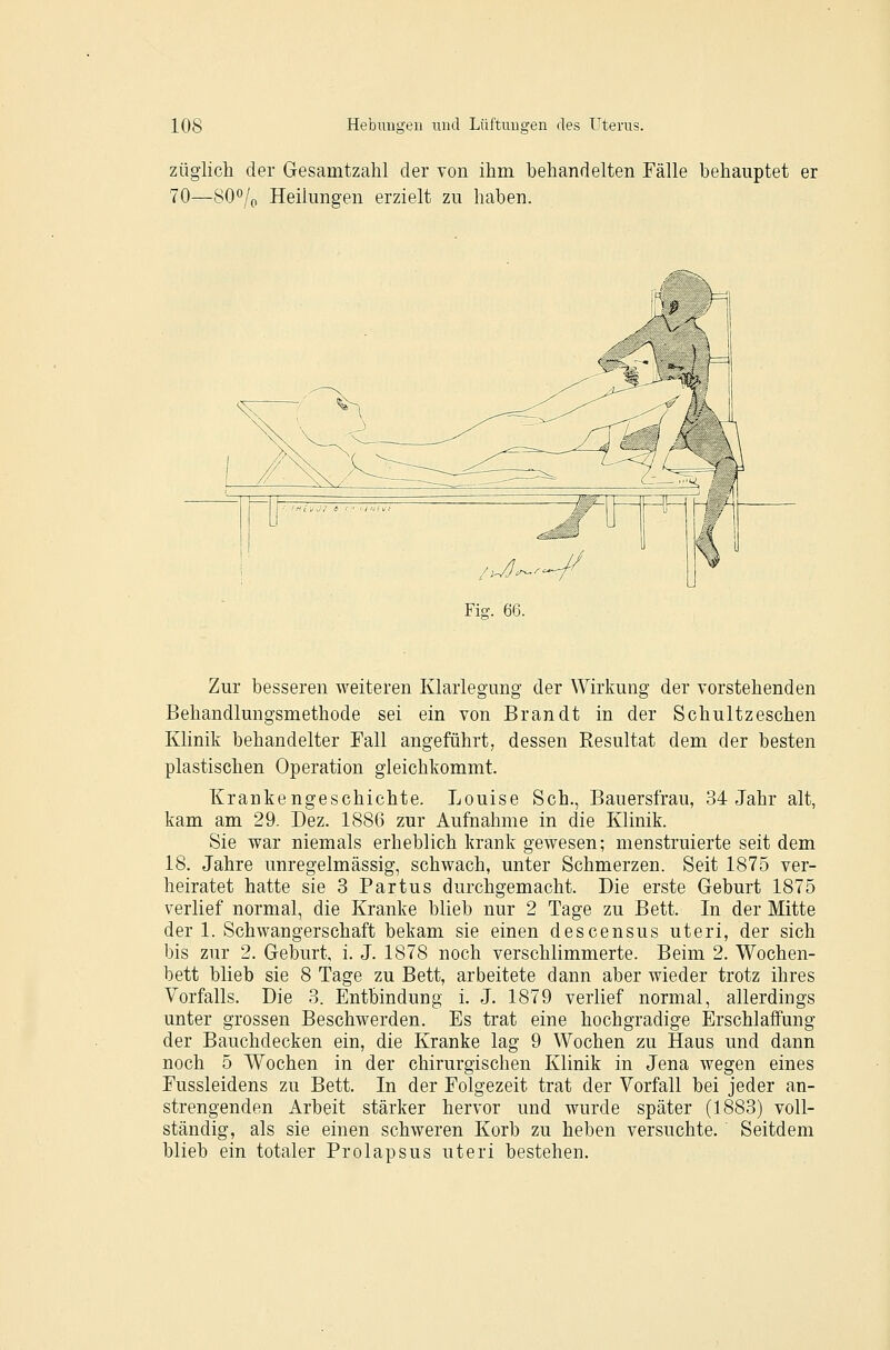 züglich der Gesamtzahl der von ihm behandelten Fälle behauptet er 70—80*^/0 Heilungen erzielt zu haben. Zur besseren weiteren Klarlegung der Wirkung der vorstehenden Behandlungsmethode sei ein von Brandt in der Schultzeschen Klinik behandelter Fall angeführt, dessen Resultat dem der besten plastischen Operation gleichkommt. Krankengeschichte. Louise Seh., Bauersfrau, 34 Jahr alt, kam am 29. Dez. 1886 zur Aufnahme in die Klinik. Sie war niemals erheblich krank gewesen; menstruierte seit dem 18. Jahre unregelmässig, schwach, unter Schmerzen. Seit 1875 ver- heiratet hatte sie 3 Partus durchgemacht. Die erste Geburt 1875 verlief normal, die Kranke blieb nur 2 Tage zu Bett. In der Mitte der 1. Schwangerschaft bekam sie einen descensus uteri, der sich bis zur 2. Geburt, i. J. 1878 noch verschlimmerte. Beim 2. Wochen- bett blieb sie 8 Tage zu Bett, arbeitete dann aber wieder trotz ihres Vorfalls. Die 3. Entbindung i. J. 1879 verlief normal, allerdings unter grossen Beschwerden. Es trat eine hochgradige Erschlaffung der Bauchdecken ein, die Kranke lag 9 Wochen zu Haus und dann noch 5 Wochen in der chirurgischen Klinik in Jena wegen eines Eussleidens zu Bett. In der Folgezeit trat der Vorfall bei jeder an- strengenden Arbeit stärker hervor und wurde später (1883) voll- ständig, als sie einen schweren Korb zu heben versuchte. Seitdem blieb ein totaler Prolapsus uteri bestehen.