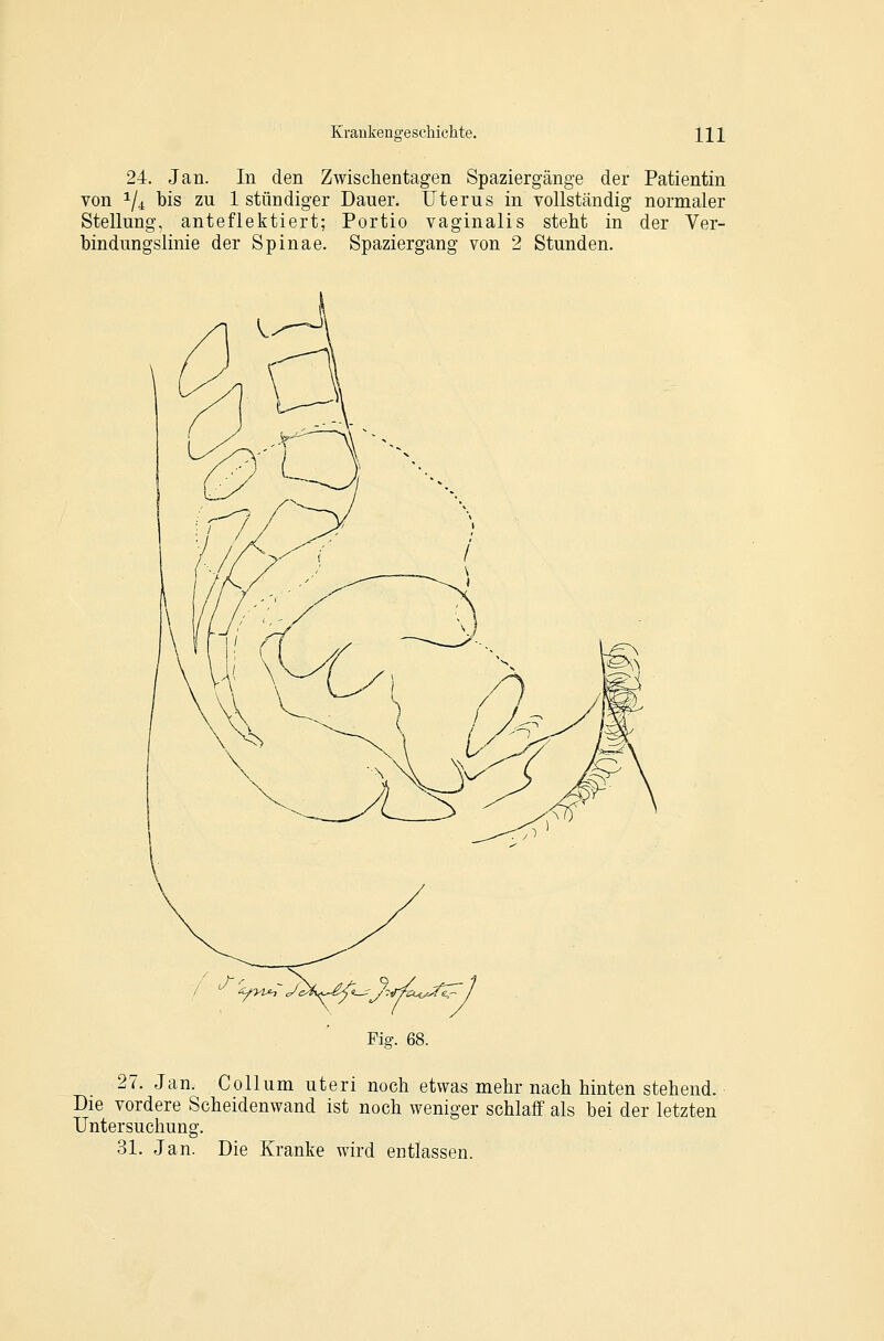 24. Jan. In den Zwischentagen Spaziergänge der Patientin von 1/4 bis zu 1 stündiger Dauer. Uterus in vollständig normaler Stellung, anteflektiert; Portio vaginalis steht in der Ver- bindungslinie der Spinae. Spaziergang von 2 Stunden. 'ifyu^ Ji Fig. 68. 27. Jan. Collum uteri noch etwas mehr nach hinten stehend. Die vordere Scheidenwand ist noch weniger schlaff als bei der letzten Untersuchung. 31. Jan. Die Kranke wird entlassen.