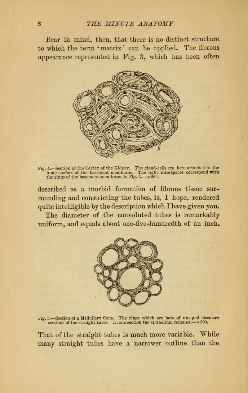 Bear in mind, then, that there is no distinct structure to which the term ' matrix? can be applied. The fibrous appearance represented in Fig. 3, which has been often Fig. 4.—Section of the Cortex of the Kidney. The gland-cells are here attached to the inner surface of the basement-membrane. The light interspaces correspond with the rings of the basement-membrane in Fig. 3.— x 200. described as a morbid formation of fibrous tissue sur- rounding and constricting the tubes, is, I hope, rendered quite intelligible by the description which I have given you. The diameter of the convoluted tubes is remarkably uniform, and equals about one-five-hundredth of an inch. Fig. 5.—Section of a Medullary Cone. The rings which are here of unequal sizes are sections of the straight tubes. In one section the epithelium remains.— x 200. That of the straight tubes is much more variable. While many straight tubes have a narrower outline than the