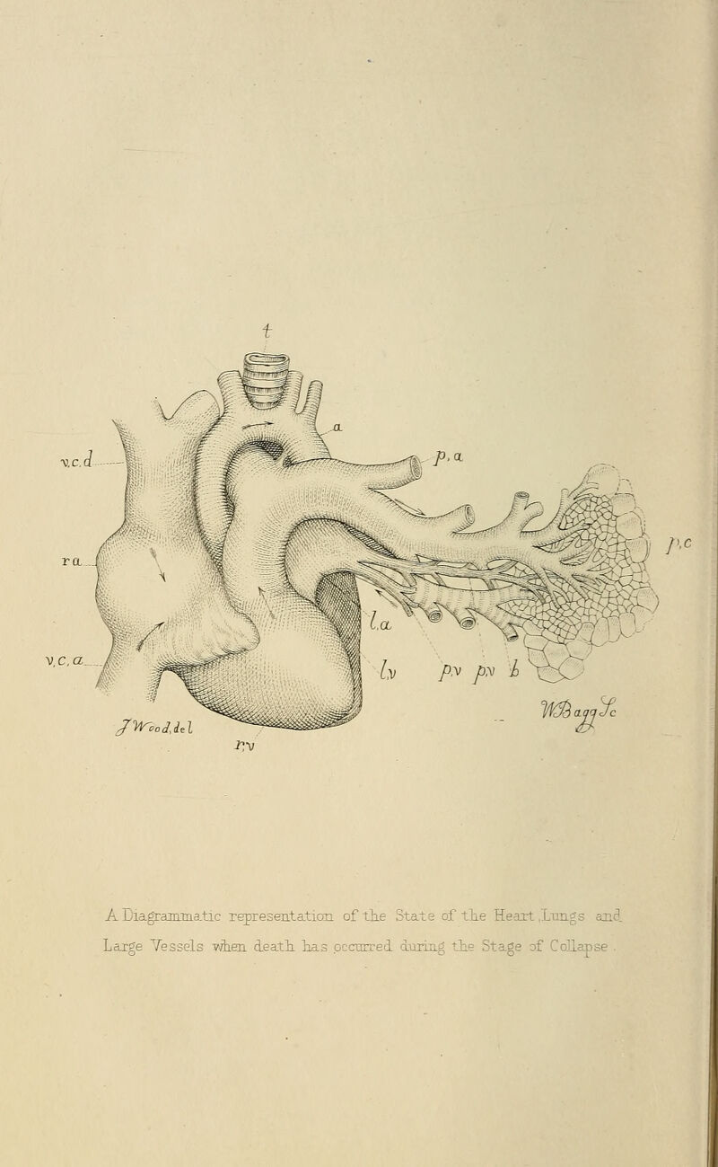 led ra. i I / /ynojiel 1 /' A Diagrammatic representation of tiie State of tlie Heart X'oiigs and Large Yessels Tdieii deatli loas pccnrred. during the Stage of CoKapse .