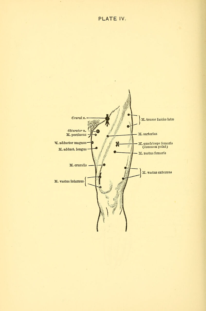 AI, adductor magnus M. adduct. longus tensor f as'cia3 lata; IT. quadriceps femoris (common point) M. rectus femoris M. vastus externua M. vastus intemus
