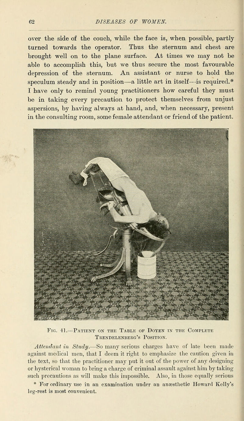 over the side of the couch, while the face is, when possible, partly turned towards the operator. Thus the sternum and chest are brought well on to the plane surface. At times we may not be able to accomplish this, but we thus secure the most favourable depression of the sternum. An assistant or nurse to hold the speculum steady and in position—a little ai't in itself—is required.* I have only to remind young practitioners how careful they must be in taking every precaution to protect themselves from unjust aspersions, by having always at hand, and, when necessary, present in the consulting room, some female attendant or friend of the patient. Fig. 41. -Patient on the Table op Doyen in the Complete Teendelenberg's Position. Attendant in Study.—So many serious charges have of late been made against medical men, that I deem it right to emphasize the caution given in the text, so that the practitioner may put it out of the power of any designing or hysterical woman to bring a charge of criminal assault against him by taking such precautions as will make this impossible. Also, in those equally serious * For ordinary use in an examination under an ansesthetic Howard Kelly's leg-rest is most convenient.