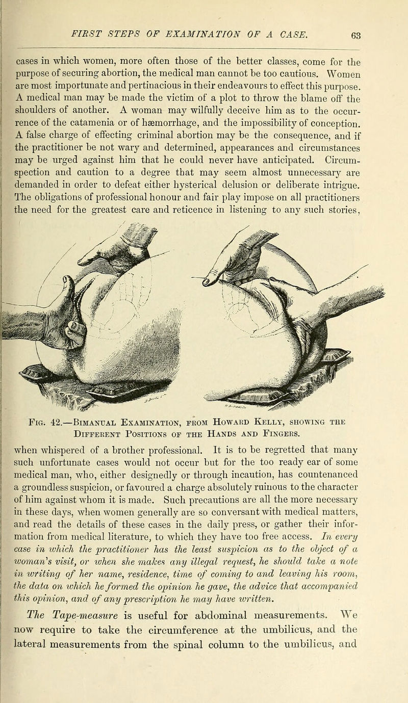 cases in which women, more often those of the better classes, come for the purpose of securing abortion, the medical man cannot be too cautious. Women are most importunate and pertinacious in their endeavours to effect this purpose. A medical man may be made the victim of a plot to throw the blame off the shoulders of another. A woman may wilfully deceive him as to the occur- rence of the catamenia or of haemorrhage, and the impossibility of conception. A false charge of effecting criminal abortion may be the consequence, and if the pi'actitioner be not wary and determined, appearances and circumstances may be urged against him that he could never have anticipated. Circum- spection and caution to a degree that may seem almost unnecessary are demanded in order to defeat either hysterical delusion or deliberate intrigue. The obligations of professional honour and fair play impose on all practitioners the need for the greatest care and reticence in listening to any such stories, Fig. 42.—Bimanual Examination, feom Howard Kelly, showing the Different Positions of the Hands and Fingers. when whispered of a brother professional. It is to be regretted that many such unfortunate cases would not occur but for the too ready ear of some medical man, who, either designedly or through incaution, has countenanced a groundless suspicion, or favoured a charge absolutely ruinous to the character of him against whom it is made. Such precautions are all the more necessary in these days, when women generally are so conversant with medical matters, and read the details of these cases in the daily press, or gather their infor- mation from medical literature, to which they have too free access. In every case in ivhich the practitioner has the least suspicion as to the object of a woman^s visit, or ivhen she onakes any illegal request, he should take a note in writing of her name, residence, time of coming to and leaving his room, the data on lohich he formed the opinion he gave, the advice that accompanied this opinion, and of any prescription he may have ivritten. The Tajoe-measure is useful for abdominal measurements. We now require to take the circumference at the umbUicus, and the lateral measurements from the spinal column to the umbilicus, and