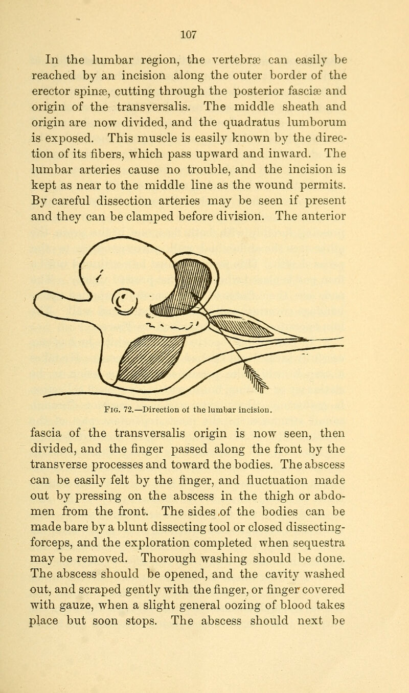 In the lumbar region, the vertebrse can easily be reached by an incision along the outer border of the erector spina?, cutting through the posterior fasciae and origin of the transversalis. The middle sheath and origin are now divided, and the quadratus lumborum is exposed. This muscle is easily known by the direc- tion of its fibers, which pass upward and inward. The lumbar arteries cause no trouble, and the incision is kept as near to the middle line as the wound permits. By careful dissection arteries may be seen if present and they can be clamped before division. The anterior Fig. 72.—Direction of the lumbar incision. fascia of the transversalis origin is now seen, then divided, and the finger passed along the front by the transverse processes and toward the bodies. The abscess can be easily felt by the finger, and fluctuation made out by pressing on the abscess in the thigh or abdo- men from the front. The sides ,of the bodies can be made bare by a blunt dissecting tool or closed dissecting- forceps, and the exploration completed when sequestra may be removed. Thorough washing should be done. The abscess should be opened, and the cavity washed out, and scraped gently with the finger, or finger covered with gauze, when a slight general oozing of blood takes place but soon stops. The abscess should next be