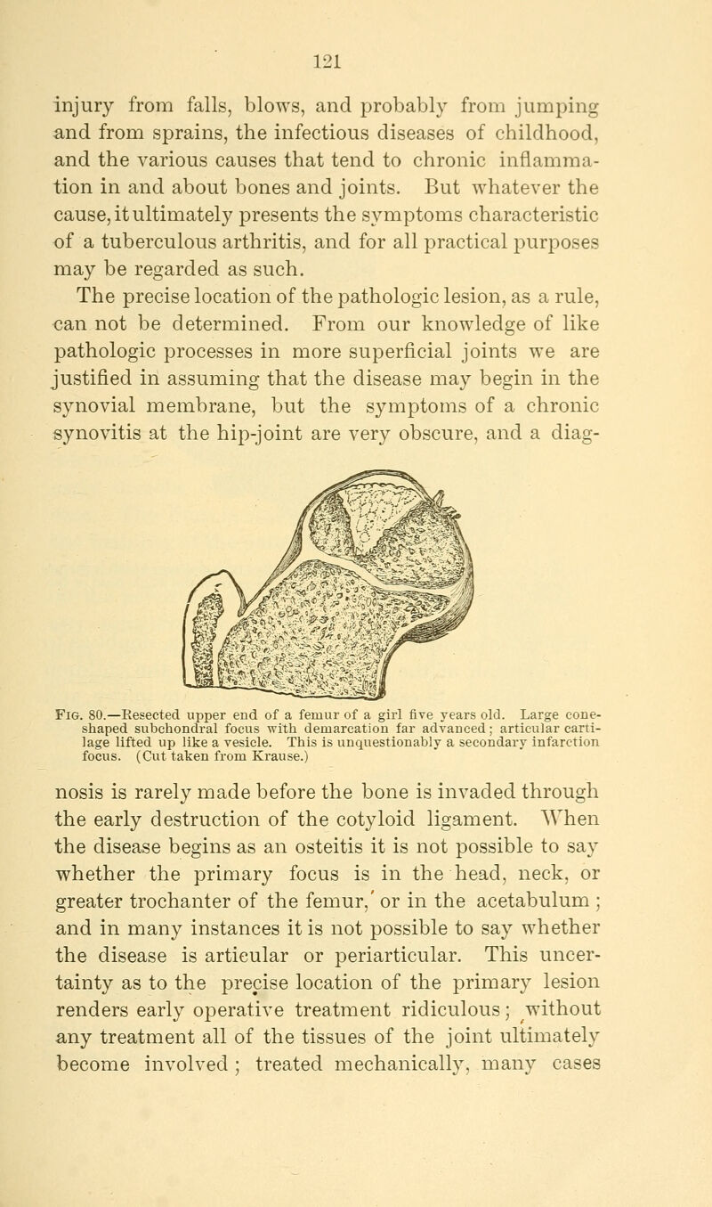 injury from falls, blows, and probably from jumping and from sprains, the infectious diseases of childhood, and the various causes that tend to chronic inflamma- tion in and about bones and joints. But whatever the cause, it ultimately presents the symptoms characteristic of a tuberculous arthritis, and for all practical purposes may be regarded as such. The precise location of the pathologic lesion, as a rule, <?an not be determined. From our knowledge of like pathologic processes in more superficial joints we are justified in assuming that the disease may begin in the synovial membrane, but the symptoms of a chronic synovitis at the hip-joint are very obscure, and a diag- Fig. 80.—Resected upper end of a femur of a girl five years old. Large cone- shaped subchondral focus with demarcation far advanced; articular carti- lage lifted up like a vesicle. This is unquestionably a secondary infarction focus. (Cut taken from Krause.) nosis is rarely made before the bone is invaded through the early destruction of the cotyloid ligament. When the disease begins as an osteitis it is not possible to say whether the primary focus is in the head, neck, or greater trochanter of the femur,' or in the acetabulum ; and in many instances it is not possible to say whether the disease is articular or periarticular. This uncer- tainty as to the precise location of the primary lesion renders early operative treatment ridiculous; without any treatment all of the tissues of the joint ultimately become involved ; treated mechanically, many cases