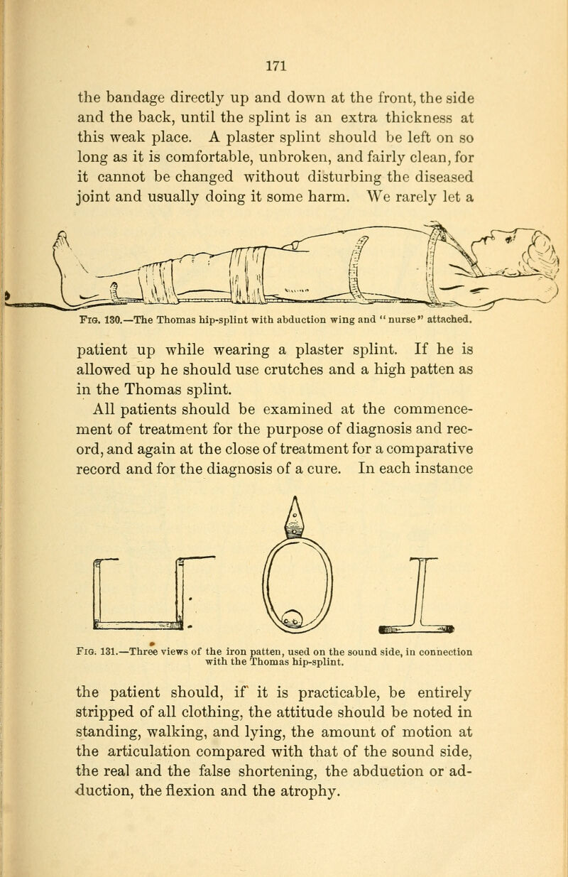 the bandage directly up and down at the front, the side and the back, until the splint is an extra thickness at this weak place. A plaster splint should be left on so long as it is comfortable, unbroken, and fairly clean, for it cannot be changed without disturbing the diseased joint and usually doing it some harm. We rarely let a Fig. 130.—The Thomas hip-splint with abduction wing and  nurse attached. patient up while wearing a plaster splint. If he is allowed up he should use crutches and a high patten as in the Thomas splint. All patients should be examined at the commence- ment of treatment for the purpose of diagnosis and rec- ord, and again at the close of treatment for a comparative record and for the diagnosis of a cure. In each instance FiG; 131.—Three views of the iron patten, used on the sound side, in connection with the Thomas hip-splint. the patient should, if it is practicable, be entirely stripped of all clothing, the attitude should be noted in standing, walking, and lying, the amount of motion at the articulation compared with that of the sound side, the real and the false shortening, the abduGtion or ad- duction, the flexion and the atrophy.