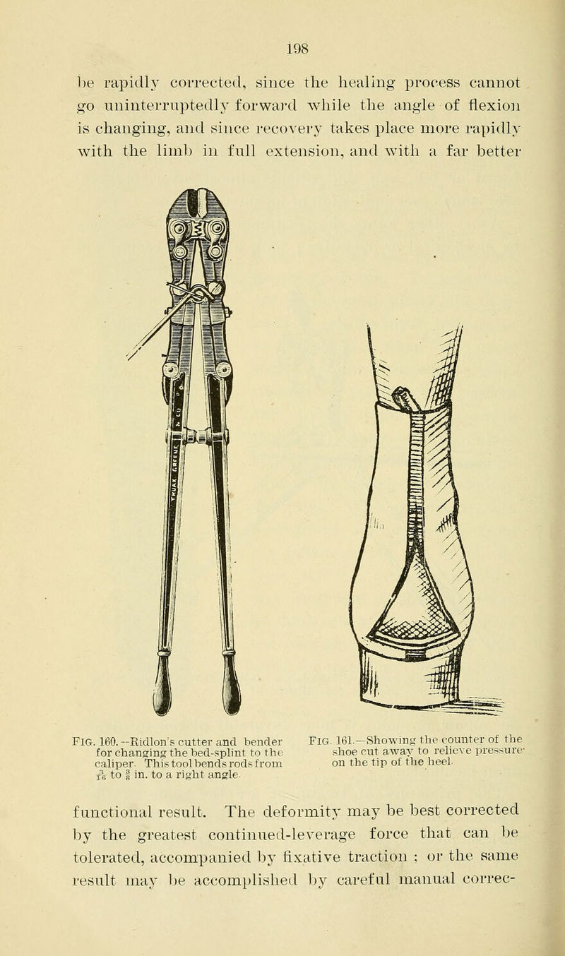 be rapidly corrected, since the healing process cannot go uninterruptedly forward while the angle of flexion is changing, and since recovery takes place more rapidly with the limb in full extension, and with a far better Fig. 160. —Ridlohs cutter and bender for changing the bed-splint to the caliper. This tool bends rods from i3s to | in. to a right angle. FIG. 161.—Showing the counter of the shoe cut away to relieve pressure- on the tip of the heel. functional result. The deformity may be best corrected by the greatest continued-leverage force that can be tolerated, accompanied by fixative traction : or the same result may be accomplished by careful manual correc-