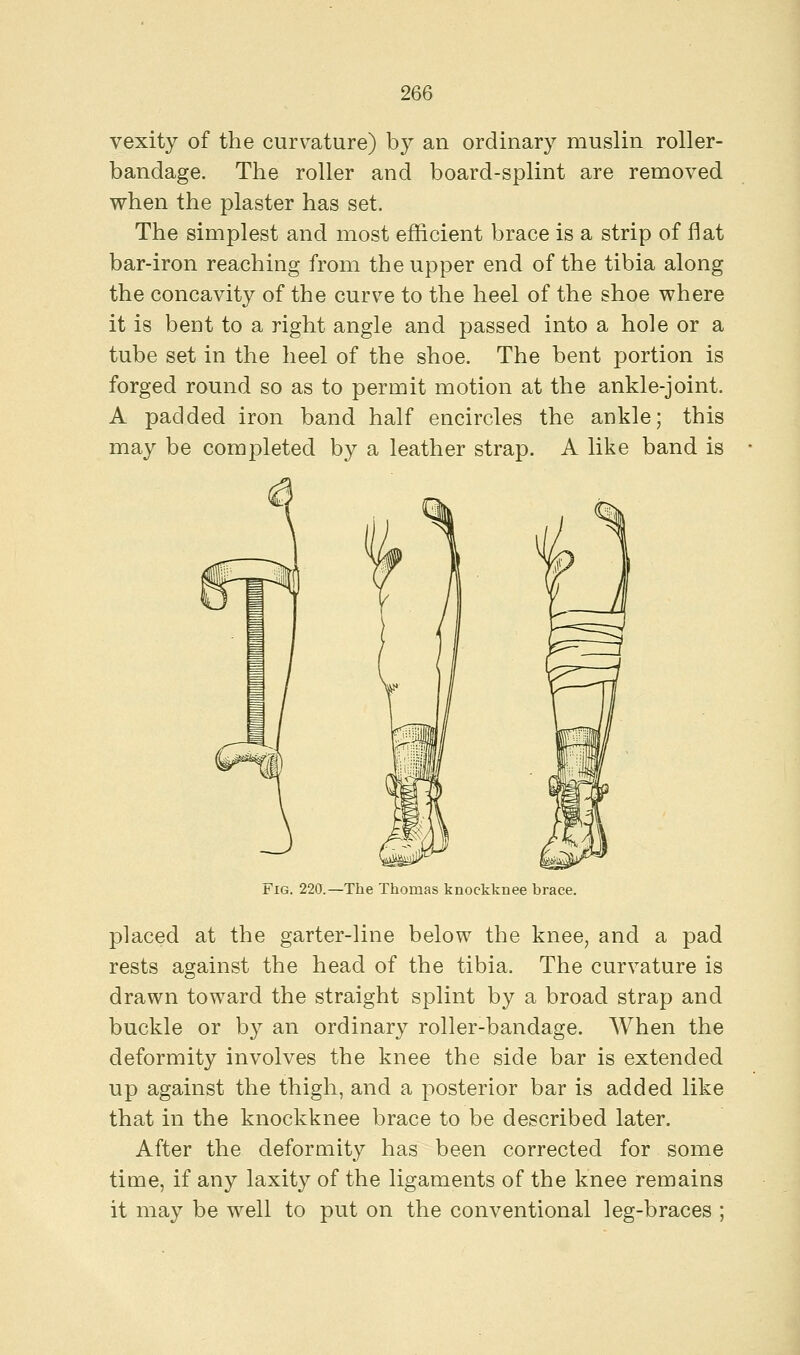 vexity of the curvature) by an ordinary muslin roller- bandage. The roller and board-splint are removed when the plaster has set. The simplest and most efficient brace is a strip of flat bar-iron reaching from the upper end of the tibia along the concavity of the curve to the heel of the shoe where it is bent to a right angle and passed into a hole or a tube set in the heel of the shoe. The bent portion is forged round so as to permit motion at the ankle-joint. A padded iron band half encircles the ankle; this may be completed by a leather strap. A like band is Fig. 220.—The Thomas knockknee brace. placed at the garter-line below the knee, and a pad rests against the head of the tibia. The curvature is drawn toward the straight splint by a broad strap and buckle or by an ordinary roller-bandage. When the deformity involves the knee the side bar is extended up against the thigh, and a posterior bar is added like that in the knockknee brace to be described later. After the deformity has been corrected for some time, if any laxity of the ligaments of the knee remains it may be well to put on the conventional leg-braces ;