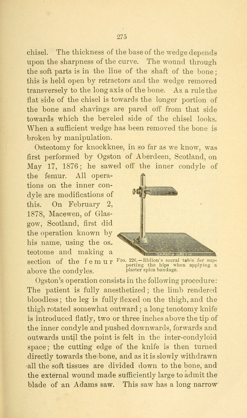 chisel. The thickness of the base of the wedge depends upon the sharpness of the curve. The wound through the soft parts is in the line of the shaft of the bone; this is held open by retractors and the wedge removed transversely to the long axis of the bone. As a rule the flat side of the chisel is towards the longer portion of the bone and shavings are pared off from that side towards which the beveled side of the chisel looks. When a sufficient wedge has been removed the bone is broken by manipulation. Osteotomy for knockknee, in so far as we know, was first performed by Ogston of Aberdeen, Scotland, on May 17, 1876; he sawed off the inner condyle of the femur. All opera- tions on the inner con- dyle are modifications of this. On February 2, 1878, Macewen, of Glas- gow, Scotland, first did the operation known by his name, using the os- teotome and making a Section Of the femur FlG- 226—Hidlon's sacral table for sup- porting the nips when applying a above the condyles. p]aster sPica bandage. Ogston's operation consists in the following procedure: The patient is fully anesthetized; the limb rendered bloodless; the leg is fully flexed on the thigh, and the thigh rotated somewhat outward; a long tenotomy knife is introduced flatly, two or three inches above the tip of the inner condyle and pushed downwards, forwards and outwards until the point is felt in the inter-condyloid space; the cutting edge of the knife is then turned directly towards the bone, and as it is slowly withdrawn all the soft tissues are divided down to the bone, and the external wound made sufficiently large to admit the blade of an Adams saw. This saw has a long narrow