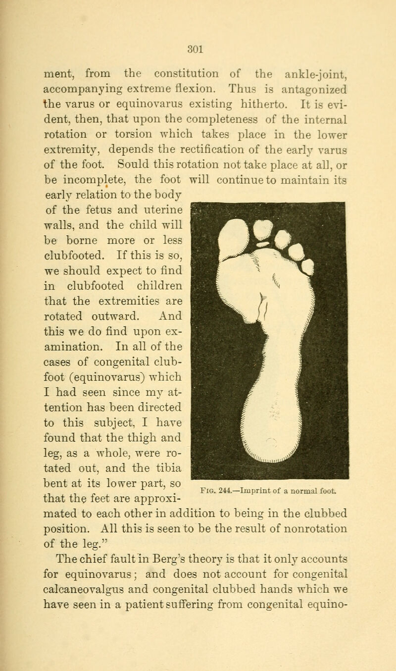 merit, from the constitution of the ankle-joint, accompanying extreme flexion. Thus is antagonized the varus or equinovarus existing hitherto. It is evi- dent, then, that upon the completeness of the internal rotation or torsion which takes place in the lower extremity, depends the rectification of the early varus of the foot. Sould this rotation not take place at all, or be incomplete, the foot will continue to maintain its early relation to the body of the fetus and uterine walls, and the child will be borne more or less clubfooted. If this is so, we should expect to find in clubfooted children that the extremities are rotated outward. And this we do find upon ex- amination. In all of the cases of congenital club- foot (equinovarus) which I had seen since my at- tention has been directed to this subject, I have found that the thigh and leg, as a whole, were ro- tated out, and the tibia bent at its lower part, so that the feet are approxi- mated to each other in addition to being in the clubbed position. All this is seen to be the result of nonrotation of the leg. The chief fault in Berg's theory is that it only accounts for equinovarus; and does not account for congenital calcaneovalgus and congenital clubbed hands which we have seen in a patient suffering from congenital equino- Fig. 244.—Imprint of a normal foot.