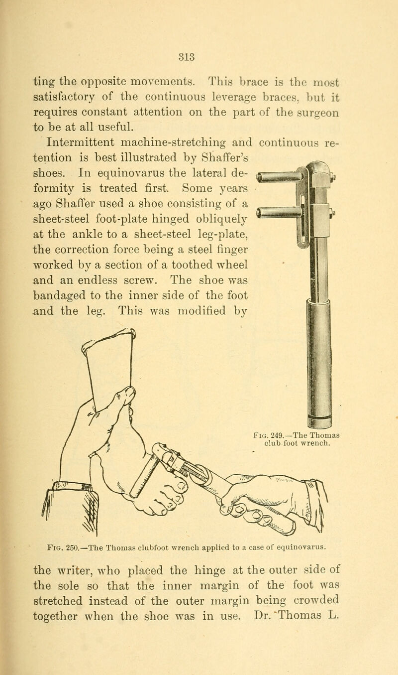 ting the opposite movements. This brace is the most satisfactory of the continuous leverage braces, but it requires constant attention on the part of the surgeon to be at all useful. Intermittent machine-stretching and continuous re- tention is best illustrated by Shaffer's shoes. In equinovarus the lateral de- formity is treated first. Some years ago Shaffer used a shoe consisting of a sheet-steel foot-plate hinged obliquely at the ankle to a sheet-steel leg-plate, the correction force being a steel finger worked by a section of a toothed wheel and an endless screw. The shoe was bandaged to the inner side of the foot and the leg. This was modified by Fig. 249.—The Thomas club foot wrench. Fig. 250.—The Thomas clubfoot wrench applied to a case of equinovarus. the writer, who placed the hinge at the outer side of the sole so that the inner margin of the foot was stretched instead of the outer margin being crowded together when the shoe was in use. Dr. ^Thomas L.