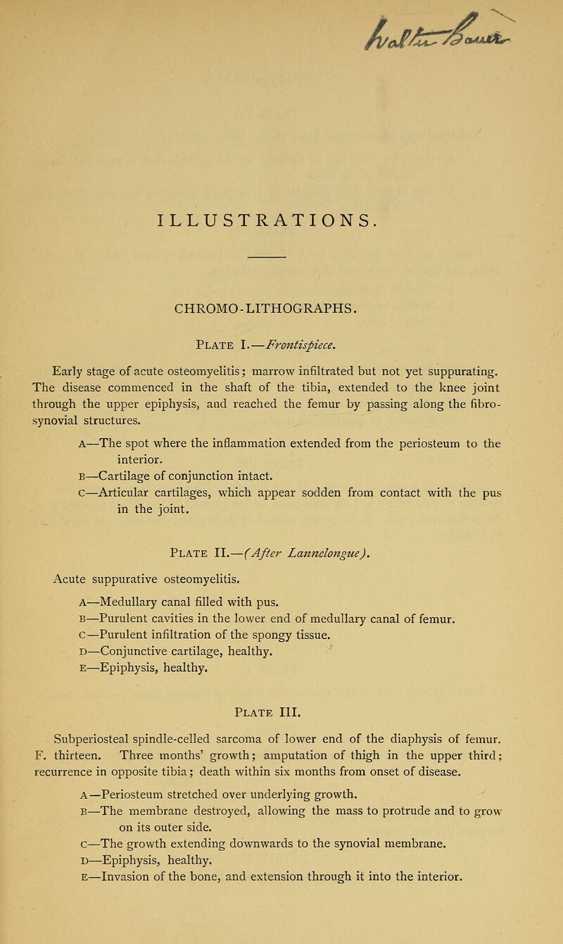 ri/cI^iZ^t^ OAXM^ ILLUSTRATIONS. CHROMO - LITHOGRAPHS. Plate I. —Frontispiece, Early stage of acute osteomyelitis; marrow infiltrated but not yet suppurating. The disease commenced in the shaft of the tibia, extended to the knee joint through the upper epiphysis, and reached the femur by passing along the fibro- synovial structures. A—The spot where the inflammation extended from the periosteum to the interior. B—Cartilage of conjunction intact. c—Articular cartilages, which appear sodden from contact with the pus in the joint. Plate II.—(After Lannelongue). Acute suppurative osteomyelitis. A—Medullary canal filled with pus. B—Purulent cavities in the lower end of medullary canal of femur. c—Purulent infiltration of the spongy tissue. D—Conjunctive cartilage, healthy. E—Epiphysis, healthy. Plate III. Subperiosteal spindle-celled sarcoma of lower end of the diaphysis of femur. F. thirteen. Three months' growth; amputation of thigh in the upper third; recurrence in opposite tibia; death within six months from onset of disease. A—Periosteum stretched over underlying growth. B—The membrane destroyed, allowing the mass to protrude and to grow on its outer side, c—The growth extending downwards to the synovial membrane. D—Epiphysis, healthy. E—Invasion of the bone, and extension through it into the interior.