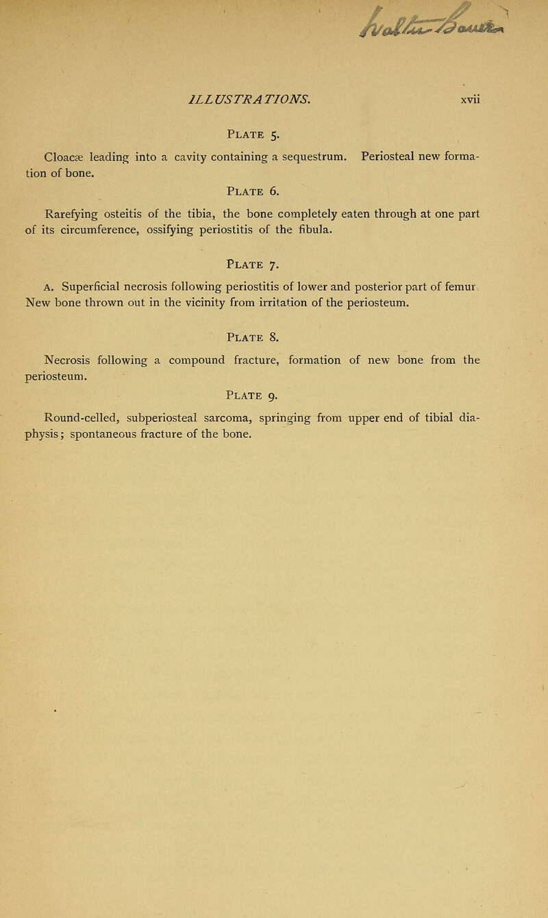 /Aa^^<^O4jU^k0k ILLUSTRATIONS. xvii Plate 5. Cloacse leading into a cavity containing a sequestrum. Periosteal new forma- tion of bone, Plate 6. Rarefying osteitis of the tibia, the bone completely eaten through at one part of its circumference, ossifying periostitis of the fibula. Plate 7. A. Superficial necrosis following periostitis of lower and posterior part of femur. New bone thrown out in the vicinity from irritation of the periosteum. Plate 8. Necrosis following a compound fracture, formation of new bone from the periosteum. Plate 9. Round-celled, subperiosteal sarcoma, springing from upper end of tibial dia- physis; spontaneous fracture of the bone.