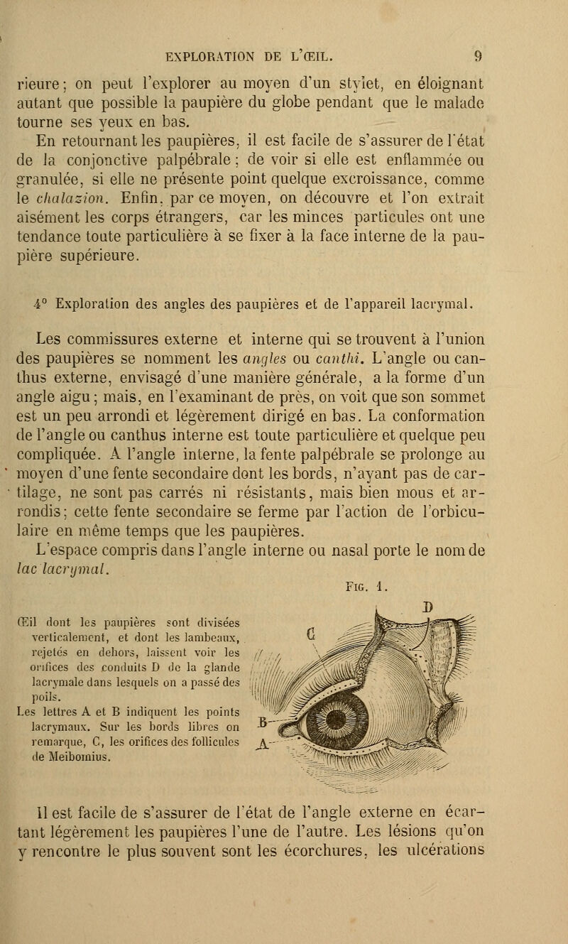 rieure ; on peut l'explorer au moyen d'un stylet, en éloignant autant que possible la paupière du globe pendant que le malade tourne ses yeux en bas. En retournant les paupières, il est facile de s'assurer de l'état de la conjonctive palpébrale ; de voir si elle est enflammée ou granulée, si elle ne présente point quelque excroissance, comme le chalazion. Enfin, par ce moyen, on découvre et l'on extrait aisément les corps étrangers, car les minces particules ont une tendance toute particulière à se fixer à la face interne de la pau- pière supérieure. 4° Exploration des angles des paupières et de l'appareil lacrymal. Les commissures externe et interne qui se trouvent à l'union des paupières se nomment les angles ou canthi. L'angle ou can- thus externe, envisagé d'une manière générale, a la forme d'un angle aigu ; mais, en l'examinant de près, on voit que son sommet est un peu arrondi et légèrement dirigé en bas. La conformation de l'angle ou canthus interne est toute particulière et quelque peu compliquée. A l'angle interne, la fente palpébrale se prolonge au moyen d'une fente secondaire dont les bords, n'ayant pas de car- tilage, ne sont pas carrés ni résistants, mais bien mous et ar- rondis ; cette fente secondaire se ferme par l'action de l'orbicu- laire en même temps que les paupières. L'espace compris dans l'angle interne ou nasal porte le nom de lac lacrymal. Œil dont les paupières sont divisées verticalement, et dont les lambeaux, rejelés en dehors, laissent voir les orifices des conduits D de la glande lacrymale dans lesquels on a passé des poils. Les lettres A et B indiquent les points lacrymaux. Sur les bords libres on remarque, C, les orifices des follicules de Meibomius. 11 est facile de s'assurer de l'état de l'angle externe en écar- tant légèrement les paupières l'une de l'autre. Les lésions qu'on y rencontre le plus souvent sont les écorchures, les ulcérations