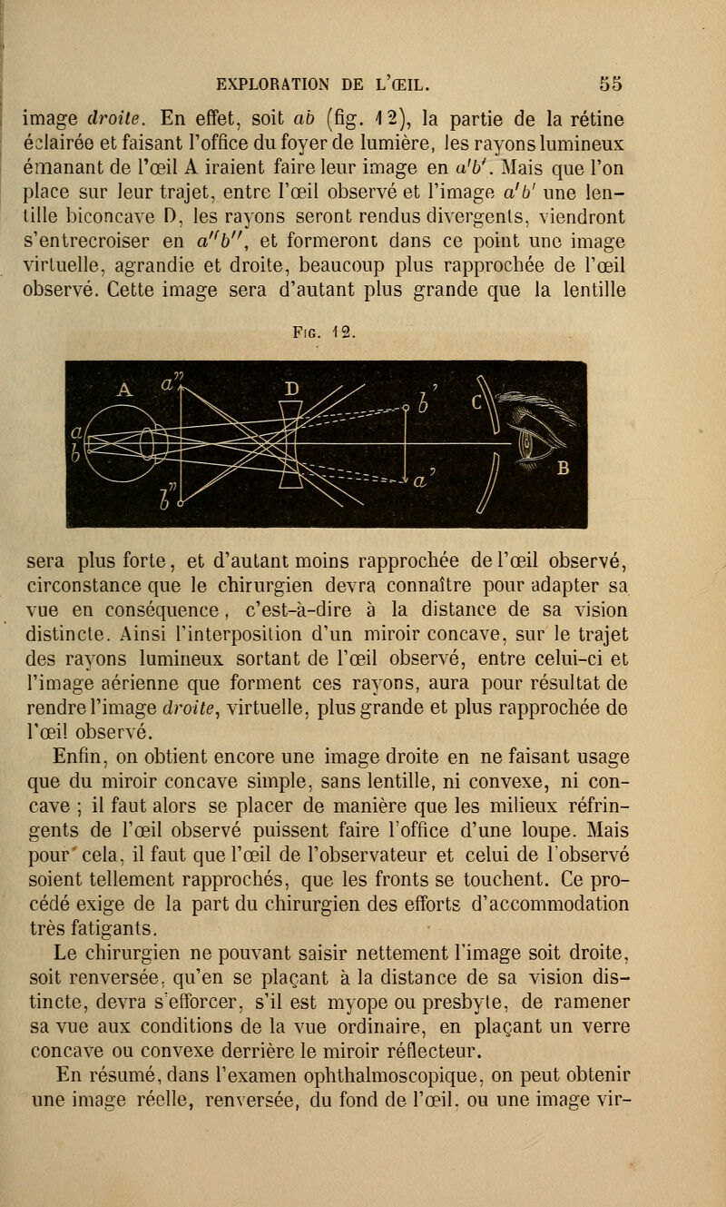 image droite. En effet, soit ab (fig. 4 2), la partie de la rétine éslairéo et faisant l'office du foyer de lumière, les rayons lumineux émanant de l'œil À iraient faire leur image en a'b'. Mais que l'on place sur leur trajet, entre l'œil observé et l'image a'b' une len- tille biconcave D, les rayons seront rendus divergents, viendront s'entrecroiser en a'(b, et formeront dans ce point une image virtuelle, agrandie et droite, beaucoup plus rapprochée de l'œil observé. Cette image sera d'autant plus grande que la lentille Fig. 12. sera plus forte, et d'autant moins rapprochée de l'œil observé, circonstance que le chirurgien devra connaître pour adapter sa vue en conséquence, c'est-à-dire à la distance de sa vision distincte. Ainsi l'interposition d'un miroir concave, sur le trajet des rayons lumineux sortant de l'œil observé, entre celui-ci et l'image aérienne que forment ces rayons, aura pour résultat de rendre l'image droite, virtuelle, plus grande et plus rapprochée de l'oeil observé. Enfin, on obtient encore une image droite en ne faisant usage que du miroir concave simple, sans lentille, ni convexe, ni con- cave ; il faut alors se placer de manière que les milieux réfrin- gents de l'œil observé puissent faire l'office d'une loupe. Mais pour' cela, il faut que l'œil de l'observateur et celui de l'observé soient tellement rapprochés, que les fronts se touchent. Ce pro- cédé exige de la part du chirurgien des efforts d'accommodation très fatigants. Le chirurgien ne pouvant saisir nettement l'image soit droite, soit renversée, qu'en se plaçant à la distance de sa vision dis- tincte, devra s'efforcer, s'il est myope ou presbyte, de ramener sa vue aux conditions de la vue ordinaire, en plaçant un verre concave ou convexe derrière le miroir réflecteur. En résumé, dans l'examen ophthalmoscopique, on peut obtenir une image réelle, renversée, du fond de l'œil, ou une image vir-