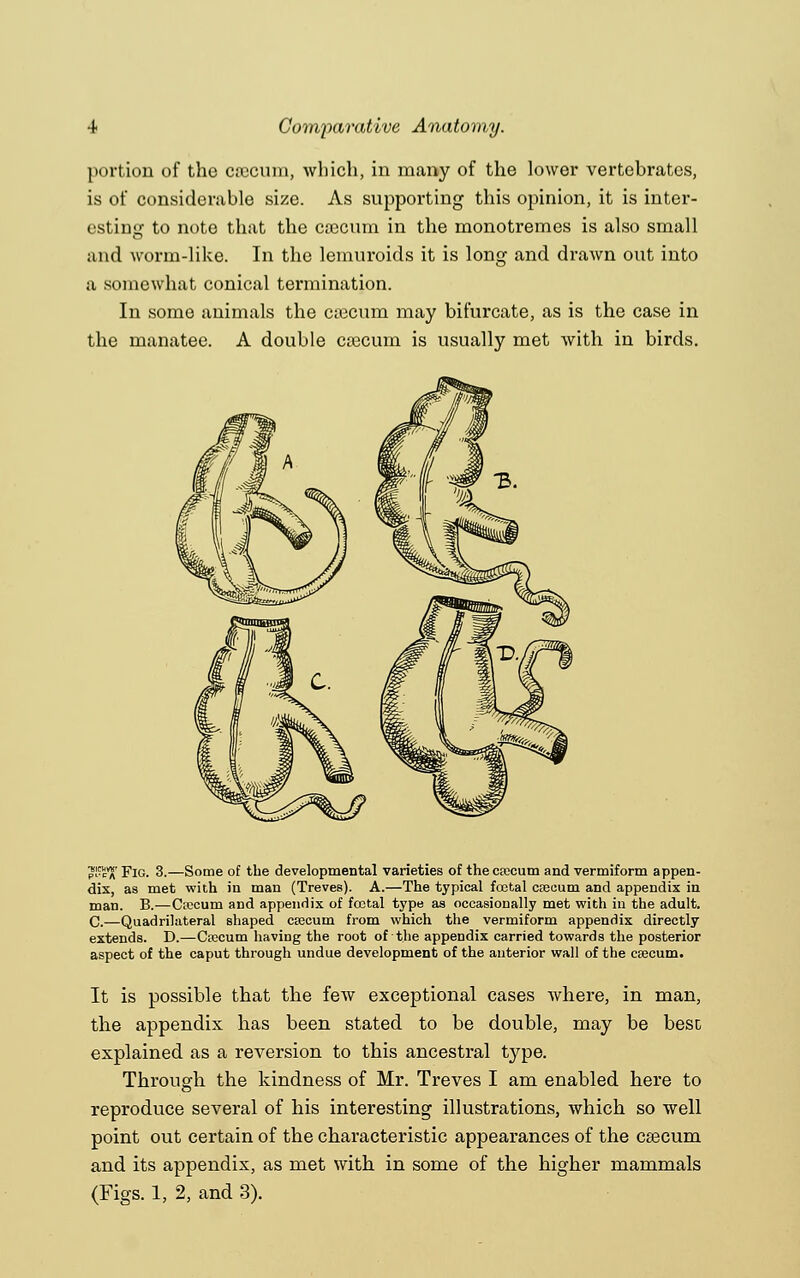 portion of the caecum, which, in many of the lower vertehrates, is of considerable size. As supporting this opinion, it is inter- esting to note that the caecum in the monotremes is also small and worm-like. In the leinuroids it is long and drawn out into a somewhat conical termination. In some animals the caecum may bifurcate, as is the case in the manatee. A double crecum is usually met with in birds. £R*a Fig. 3.—Some of the developmental varieties of the caecum and vermiform appen- dix, as met with in man (Treves). A.—The typical foetal caecum and appendix in man. B.—Caecum and appendix of foetal type as occasionally met with in the adult. C.—Quadrilateral shaped caecum from which the vermiform appendix directly extends. D.—Caecum having the root of the appendix carried towards the posterior aspect of the caput through undue development of the anterior wall of the caecum. It is possible that the feAv exceptional cases where, in man, the appendix has been stated to be double, may be best explained as a reversion to this ancestral type. Through the kindness of Mr. Treves I am enabled here to reproduce several of his interesting illustrations, which so well point out certain of the characteristic appearances of the csecum and its appendix, as met with in some of the higher mammals (Figs. 1, 2, and 3).