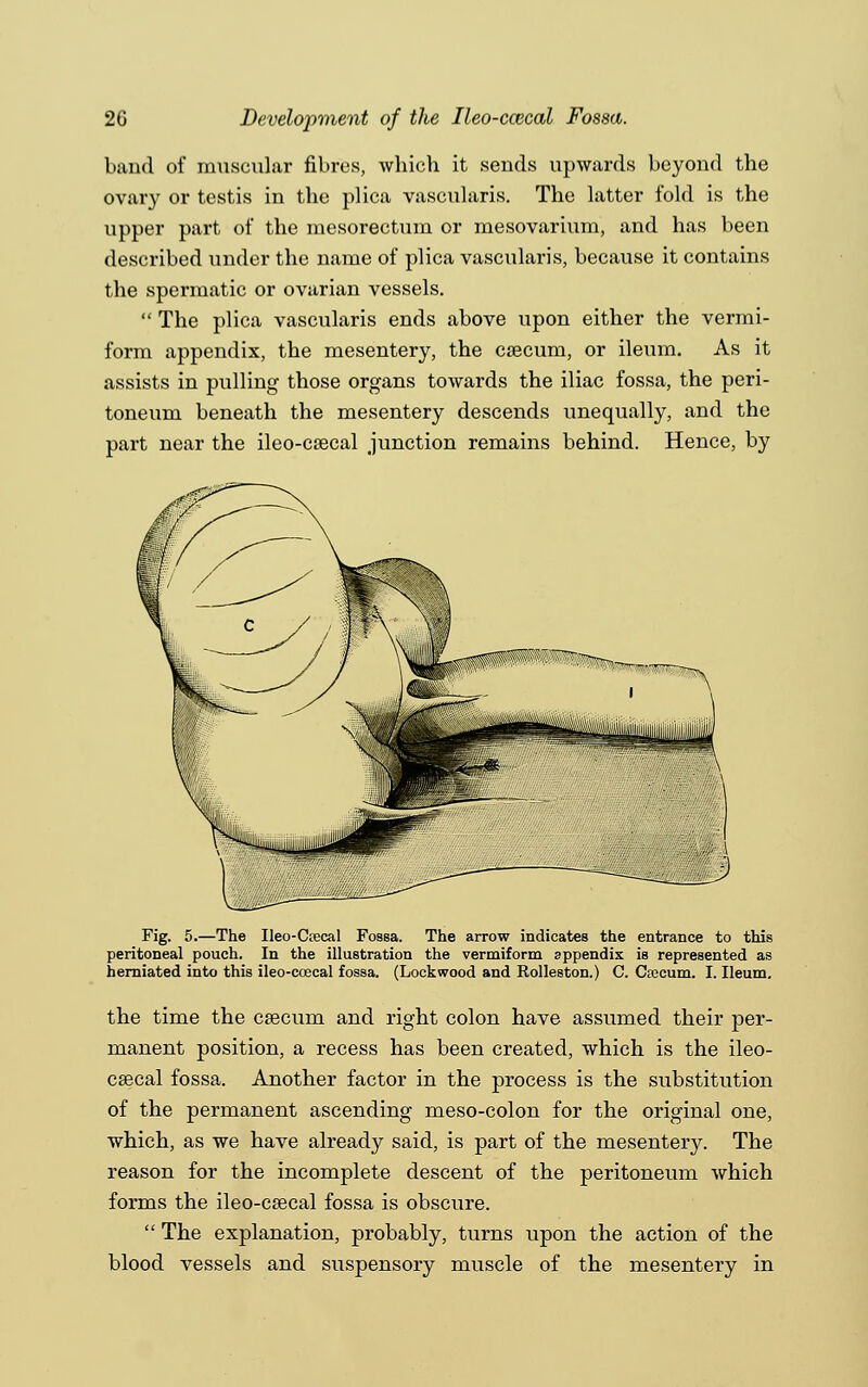 band of muscular fibres, which it sends upwards beyond the ovary or testis in the plica vascularis. The latter fold is the upper part of the niesorectum or mesovarium, and has been described under the name of plica vascularis, because it contains the spermatic or ovarian vessels.  The plica vascularis ends above upon either the vermi- form appendix, the mesentery, the caecum, or ileum. As it assists in pulling those organs towards the iliac fossa, the peri- toneum beneath the mesentery descends unequally, and the part near the ileo-csecal junction remains behind. Hence, by Fig. 5.—The Ileo-Ctecal Fossa. The arrow indicates the entrance to this peritoneal pouch. In the illustration the vermiform appendix is represented as herniated into this ileo-coecal fossa. (Lockwood and Rolleston.) C. Cascum. I. Ileum. the time the caecum and right colon have assumed their per- manent position, a recess has been created, which is the ileo- caecal fossa. Another factor in the process is the substitution of the permanent ascending meso-colon for the original one, which, as we have already said, is part of the mesentery. The reason for the incomplete descent of the peritoneum which forms the ileo-csecal fossa is obscure.  The explanation, probably, turns upon the action of the blood vessels and suspensory muscle of the mesentery in