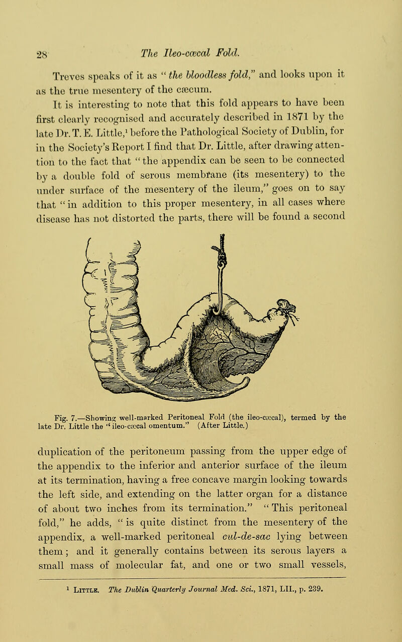 Treves speaks of it as  the bloodless fold, and looks upon it as the true mesentery of the caecum. 11 is interesting to note that this fold appears to have been first clearly recognised and accurately described in 1871 by the late Dr. T. E. Little,1 before the Pathological Society of Dublin, for in the Society's Report I find that Dr. Little, after drawing atten- tion to the fact that the appendix can be seen to be connected by a double fold of serous membrane (its mesentery) to the under surface of the mesentery of the ileum, goes on to say that  in addition to this proper mesentery, in all cases where disease has not distorted the parts, there will be found a second Fig. 7.—Showing; well-marked Peritoneal Fold (the ileo-crceal), termed by the late Dr. Little ihe  ileo-efcoal omentum. (After Little.) duplication of the peritoneum passing from the upper edge of the appendix to the inferior and anterior surface of the ileum at its termination, having a free concave margin looking towards the left side, and extending on the latter organ for a distance of about two inches from its termination.  This peritoneal fold, he adds,  is quite distinct from the mesentery of the appendix, a well-marked peritoneal cid-de-sac lying between them; and it generally contains between its serous layers a small mass of molecular fat, and one or two small vessels, Little. The Dublin Quarterly Journal Med. Sci., 1871, LIL, p. 239.