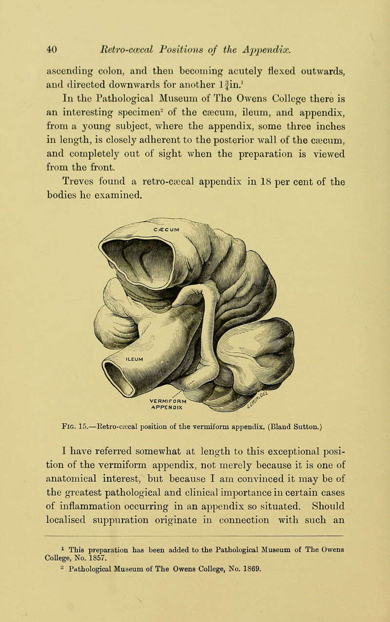 ascending colon, and then becoming acutely Hexed outwards, and directed downwards for another l^in.1 In the Pathological Museum of The Owens College there is an interesting specimen- of the csecum, ileum, and appendix, from a young subject, where the appendix, some three inches in length, is closely adherent to the posterior wall of the cajcum, and completely out of sight when the preparation is viewed from the front. Treves found a retro-ca3cal appendix in 18 per cent of the bodies he examined. Fig. 15.—Ketro-ctccal position of the vermiform appendix. (Bland Sutton.) I have referred somewhat at length to this exceptional posi- tion of the vermiform appendix, not merely because it is one of anatomical interest, but because I am convinced it may be of the greatest pathological and clinical importance in certain cases of inflammation occurring in an appendix so situated. Should localised suppuration originate in connection with such an 1 This preparation has been added to the Pathological Museum of The Owens College, No. 1857. 2 Pathological Museum of The Owens College, No. 1869.