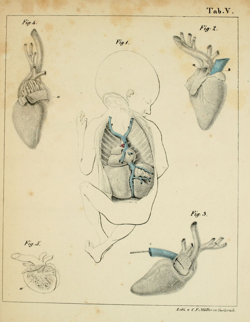 Tal, .V, Fi'asÄ ■ «%^^1 /V/. F^Z. 01 :^ J f^'-^J Fi^. 5. M n. J:.ify, V C ft-timZcr m CarZiru^?^