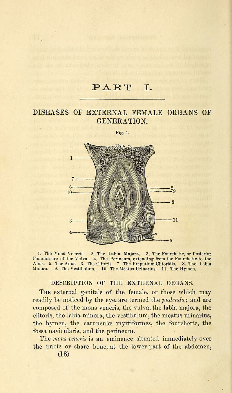 I>A.KT I. DISEASES OF EXTERNAL FEMALE ORGANS OF GENERATION. Fig. 1. XV ^ 1—■ \ 1. The Mons Veneris. 2. The Labia Majora. 3. The Fourchette, or Posterior Commissure of the Valva. 4. The Perineum, extending from the Fourchette to the Anus. 5. The Anus. 6. The Clitoris. 7. The Preputium Clitoridis. 8. The Labia Minora. 9. The Vestibulum, 10. The Meatus Urinarius. 11. The Hymen, DESCKIPTION OF THE EXTERNAL ORGANS. The external genitals of the female, or those which may readily be noticed by the eye, are termed the pudenda; and are composed of the mons veneris, the vulva, the labia majora, the clitoris, the labia minora, the vestibulum, the meatus urinarius, the hymen, the carunculee myrtiformes, the fourchette, the fossa navicularis, and the perineum. The mons veneris is an eminence situated immediately over the pubic or share bone, at the lower part of the abdomen,