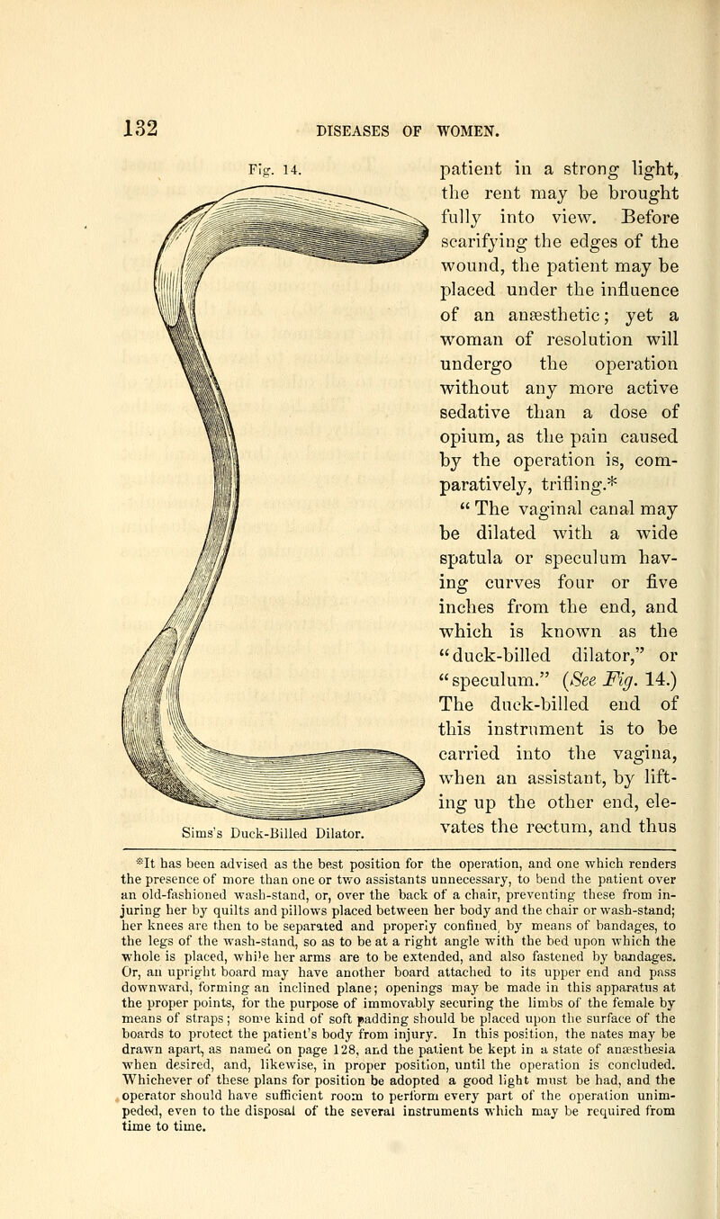 Fig-. 14. Sims's Duck-Billed Dilator. patient in a strong light, the rent may be brought fully into view. Before scarifying the edges of the wound, the patient may be placed under the inlSuence of an ansesthetic; yet a woman of resolution will undergo the operation without any more active sedative than a dose of opium, as the pain caused by the operation is, com- paratively, trifling.*  The vaginal canal may be dilated with a wide spatula or speculum hav- ing curves four or five inches from the end, and which is known as the duck-billed dilator, or speculum. {See Fig. 14:) The duck-billed end of this instrument is to be carried into the vagina, when an assistant, by lift- ing up the other end, ele- vates the rectum, and thus *It has been advised as the best position for the operation, and one which renders the presence of more than one or two assistants unnecessary, to bend the patient over an old-fashioned wash-stand, or, over the back of a chair, preventing these from in- juring her by quilts and pillows placed between her body and the chair or wash-stand; her knees are then to be separated and properly confined, by means of bandages, to the legs of the wash-stand, so as to be at a right angle with the bed upon which the whole is placed, while her arms are to be extended, and also fastened by bandages. Or, an upright board may have another board attached to its upper end and pass downward, forming an inclined plane; openings maybe made in this apparatus at the proper points, for the purpose of immovably securing the limbs of the female by means of straps; some kind of soft padding should be placed upon the surface of the boards to protect the patient's body from injury. In this position, the nates may be drawn apart, as named on page 128, and the patient be kept in a state of anaesthesia when desired, and, likewise, in proper position, until the operation is concluded. Whichever of these plans for position be adopted a good light must be had, and the operator should have sufficient room to perform every part of the operation unim- peded, even to the disposal of the several instruments which may be required from time to time.