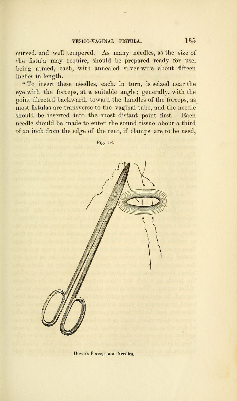 curved, and well tempered. As many needles, as the size of the fistula may require, should be prepared ready for use, being armed, each, with annealed silver-wire about fifteen inches in length.  To insert these needles, each, in turn, is seized near the eye with the forceps, at a suitable angle; generally, with the point directed backward, toward the handles of the forceps, as most fistulas are transverse to the vaginal tube, and the needle should be inserted into the most distant point first. Each needle should be made to enter the sound tissue about a third of an inch from the edge of the rent, if clamps are to be used, Fig. 16. Howe's Forceps and Needles.