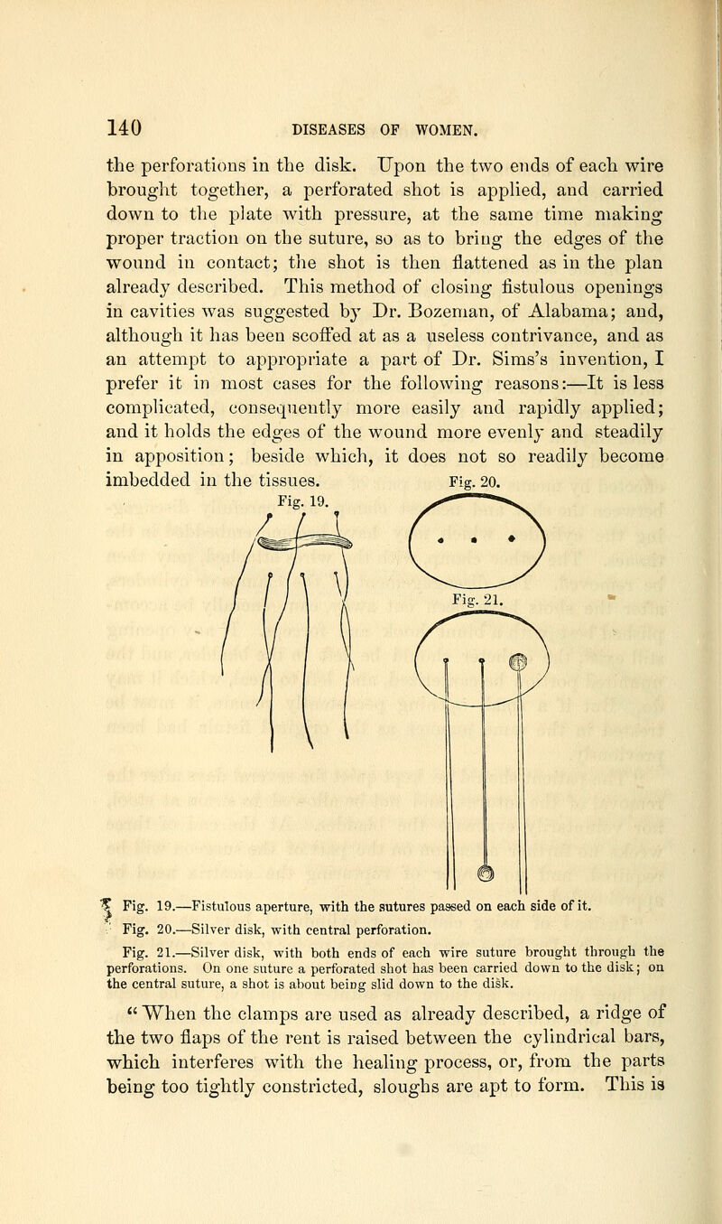 the perforations in the disk. Upon the two ends of each wire brought together, a perforated shot is applied, and carried down to the plate with pressure, at the same time making proper traction on the suture, so as to bring the edges of the wound in contact; the shot is then flattened as in the plan already described. This method of closing fistulous openings in cavities was suggested by Dr. Bozeman, of Alabama; and, although it has been scoffed at as a useless contrivance, and as an attempt to appropriate a part of Dr. Sims's invention, I prefer it in most cases for the following reasons:—It is less complicated, consequently more easily and rapidly applied; and it holds the edges of the wound more evenly and steadily in apposition; beside which, it does not so readily become imbedded in the tissues. Fig. 20. Fig. 19. ^ Fig. 19.—Fistulous aperture, with the sutures passed on each side of it. .' Fig. 20.—Silver disk, with central perforation. Fig. 21.—Silver disk, with both ends of each wire suture brought through the perforations. On one suture a perforated shot has been carried down to the disk; on the central suture, a shot is about being slid down to the disk.  When the clamps are used as already described, a ridge of the two flaps of the rent is raised between the cylindrical bars, which interferes with the healing process, or, from the parts being too tightly constricted, sloughs are apt to form. This is